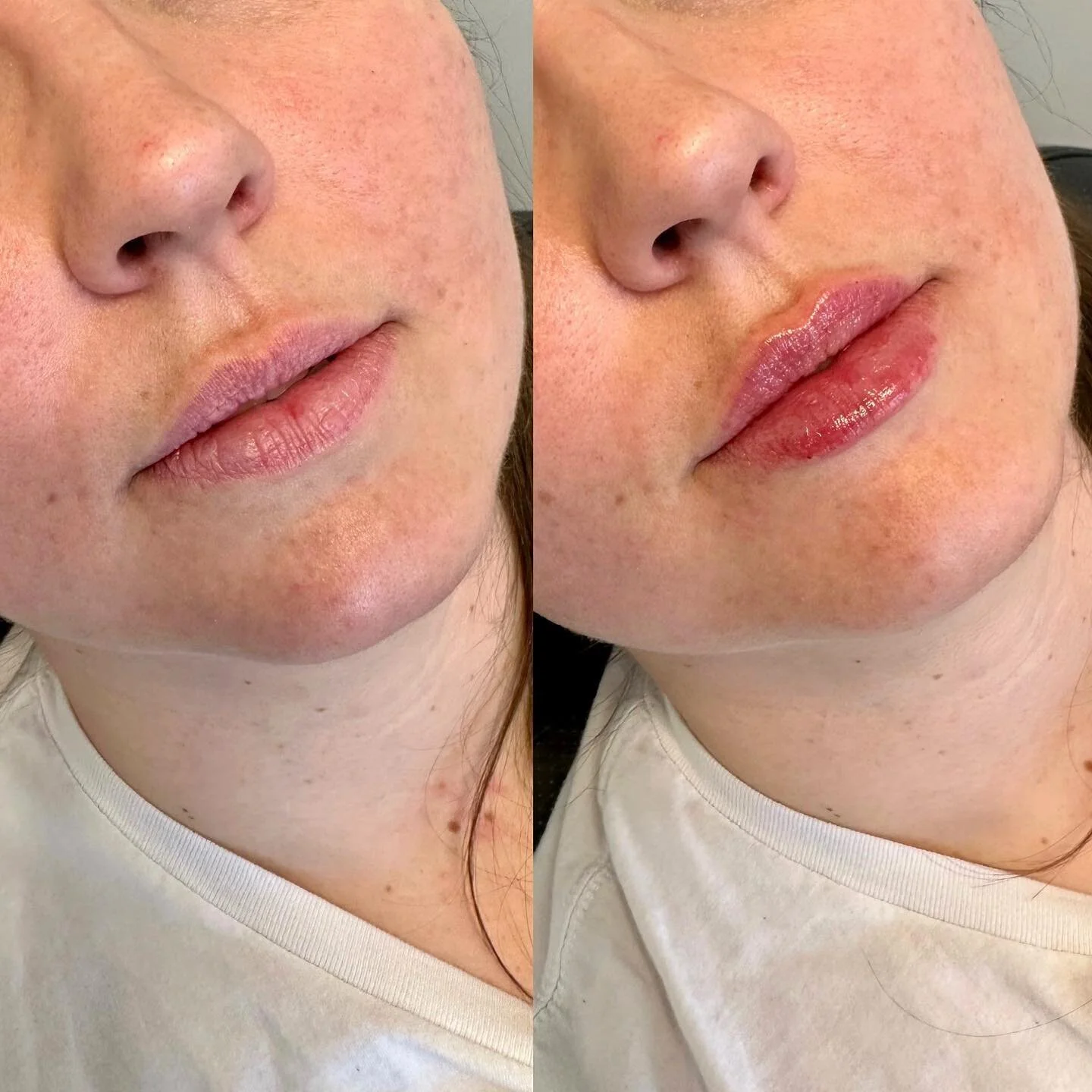 These cutie lips deserve a before & after. ๐