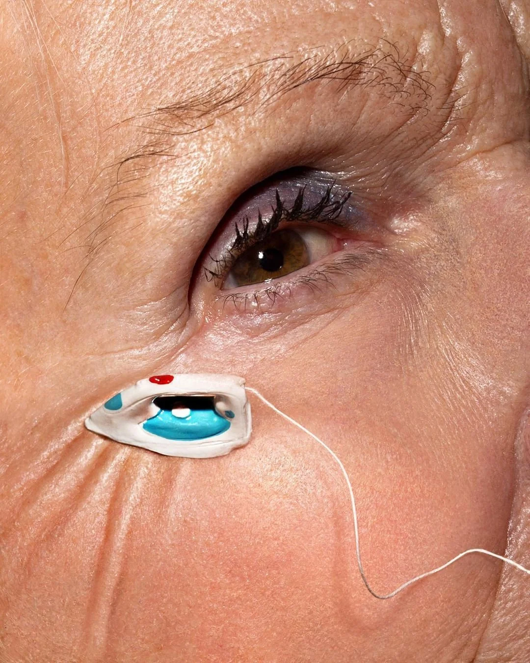 is botox safe?
