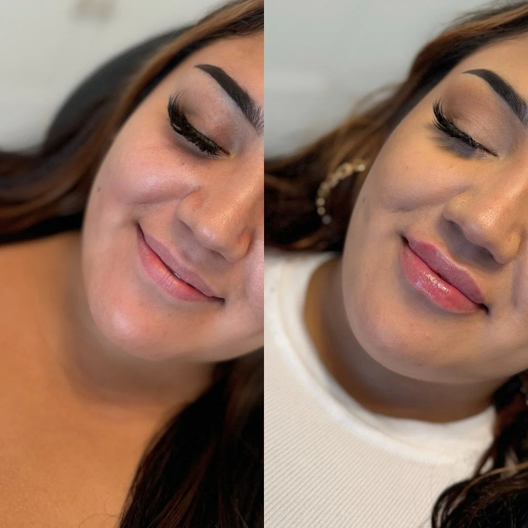 LIP FILLER 🖤

➕Product: Full Syringe Restylane Kysse
➕Length of Appointment: 30-45 mins
➕Duration of Product: 6-9 months
➕Pain: Minimal, with numbing cream
➕Common Side Effects: Swelling/bruising
➕Location: Franks by Frida, Victoria Park

DM for any