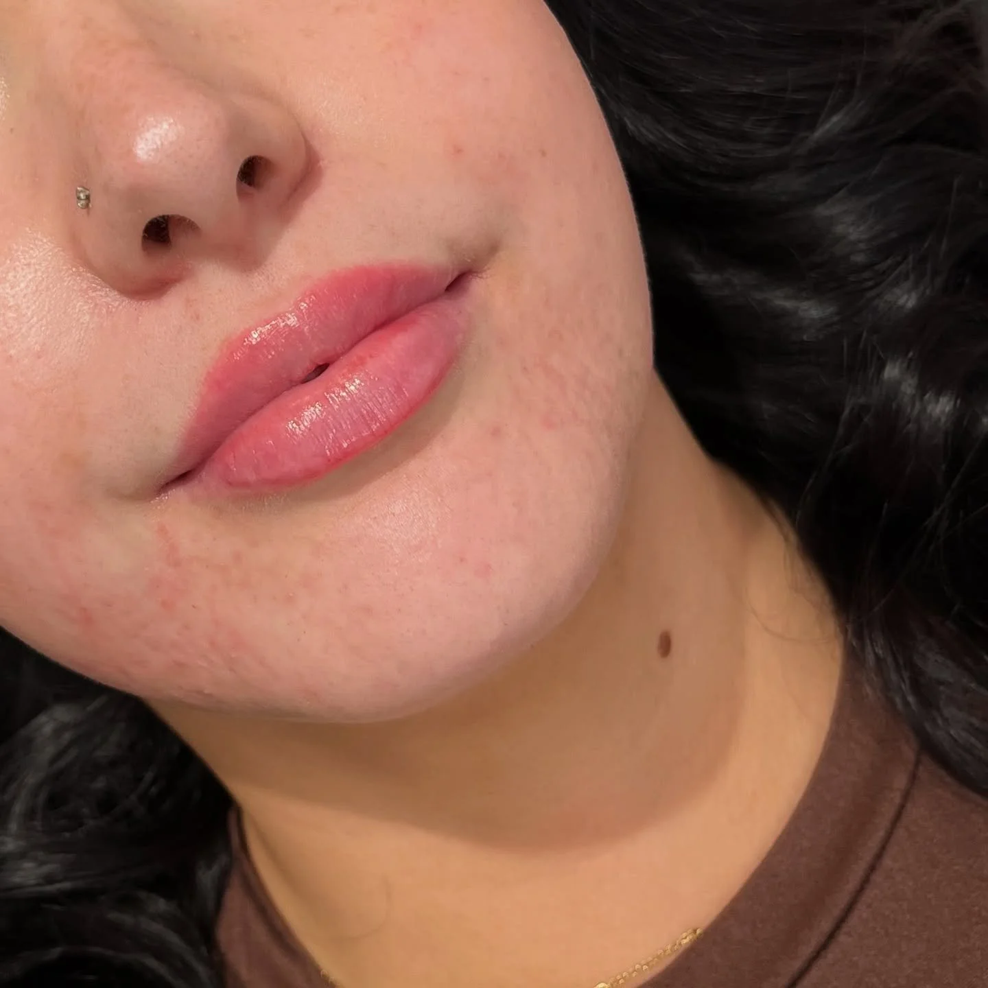 Something people don&rsquo;t talk about enough with lip filler? Just how good it feels to do something for yourself. Not for anyone else&rsquo;s opinion, not because you &ldquo;should&rdquo;, but because it makes you feel a little more confident, a l