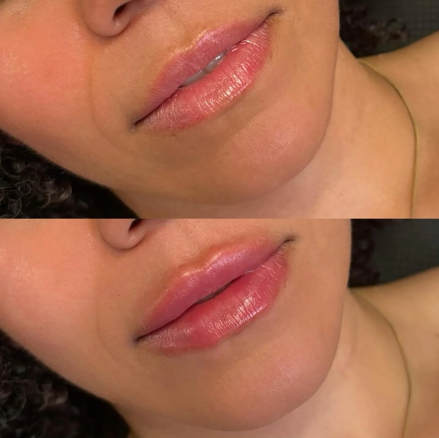 Stampede is comin up quick quick Calgary🤠🐎🤎 

First, we need those cowboys boots but flawless lips come as a close second💋

At this appointment we went all in and did a full syringe on these stunning lips. Book w/ me and let&rsquo;s get you stamp