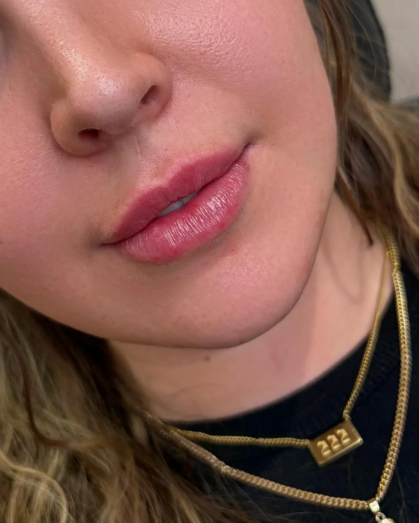 Think I&rsquo;m a wee bit lip obsessed👄🙊

Officially flying solo and loving every minute of it! Preceptorship complete, and these lips are just the beginning✨ Hugeee thanks to the amazing injectors who taught me and the sweetest clients I got to me