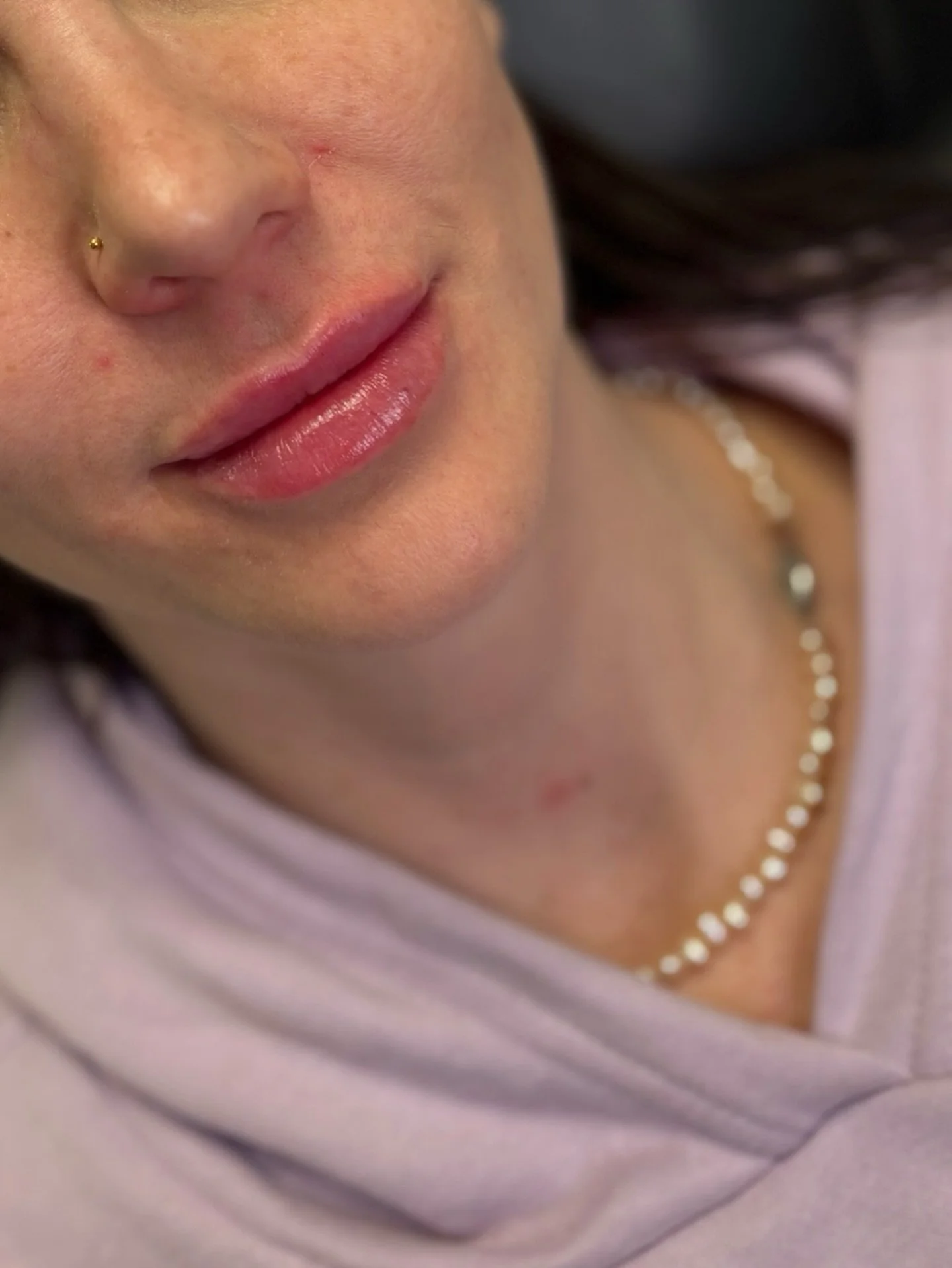 Bold, beautiful lips 👄 boo ya babyyy!!

This client dissolved her lips almost a year ago, giving us a true blank slate to work with. 

We went all in with a full syringe to create a juicy, balanced result that complements her natural shape 😚

&bull