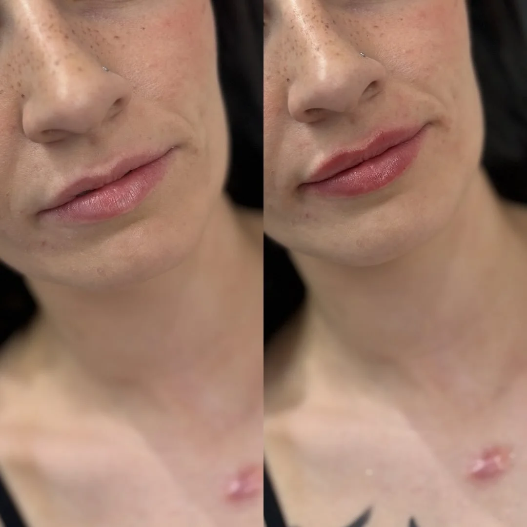 who doesn&rsquo;t feel a little better with a lil lip refresh? 😌👄

&bull;

&bull;

&bull;

@frida.maura.selleck