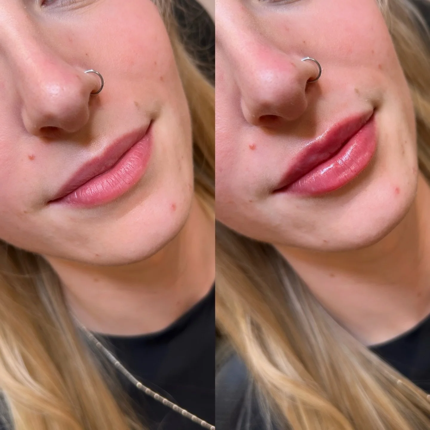 So pretty 🙂&zwj;&harr;️

Lips by me . 

#halfsyringe #lipfillerinspo #lipfilleryyc #yyclipfiller #yycinjections
