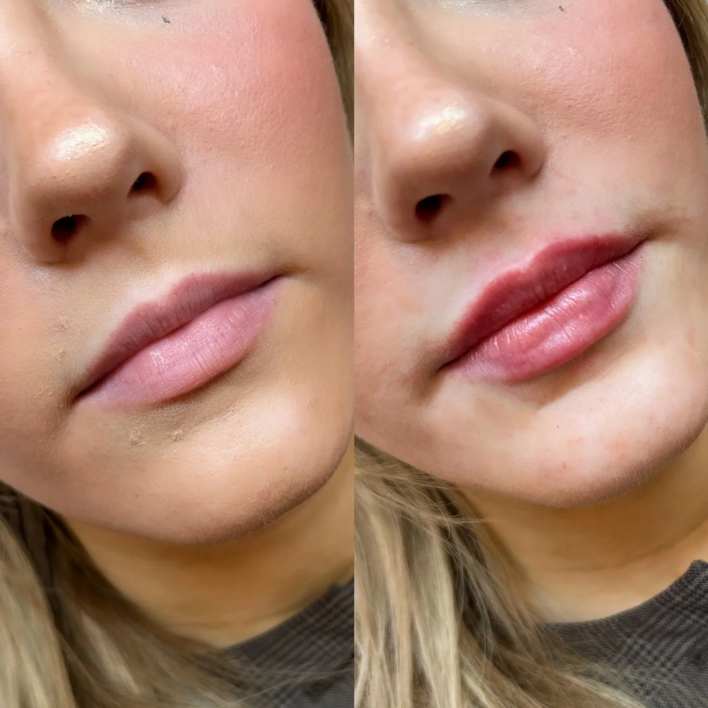 LIPS by me 🍒
