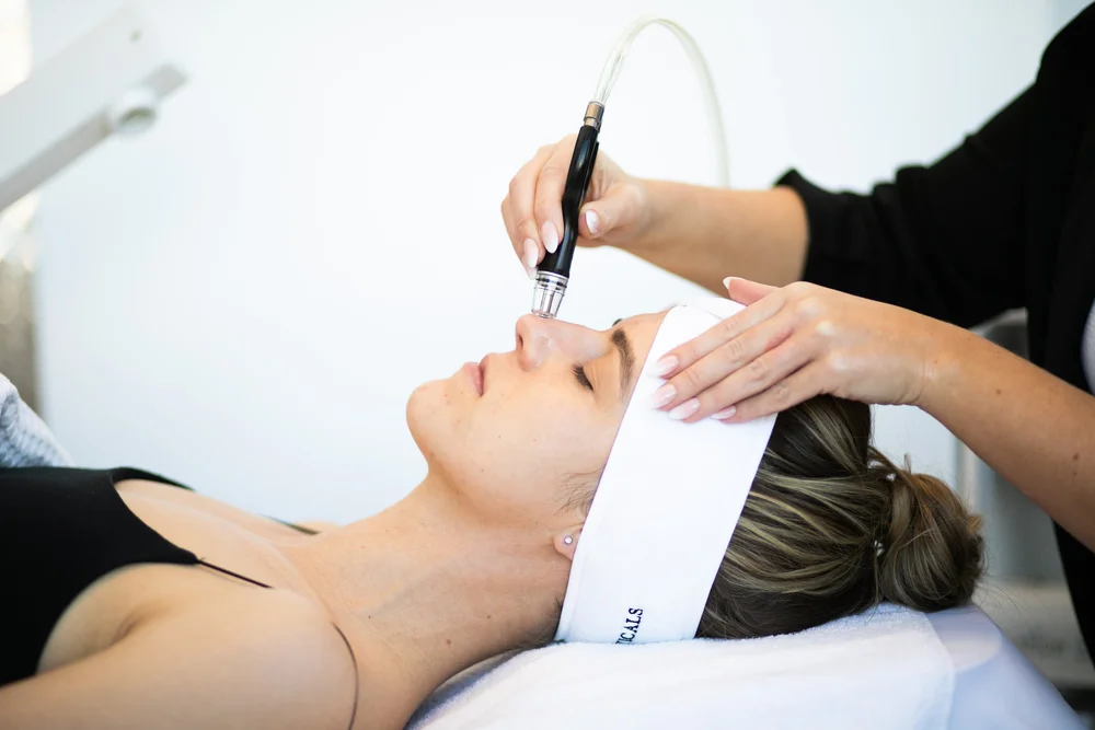 Calgary's GoTo Facial Spot Facials, Peels, Laser, Microderm, Clear+