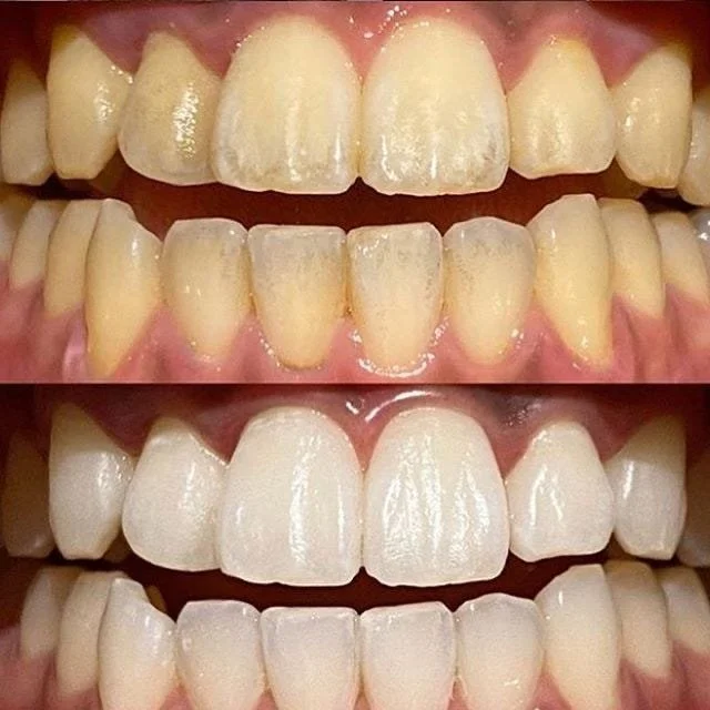28bb9bb2-0611-422d-ba63-0e283e1bd636.jpg