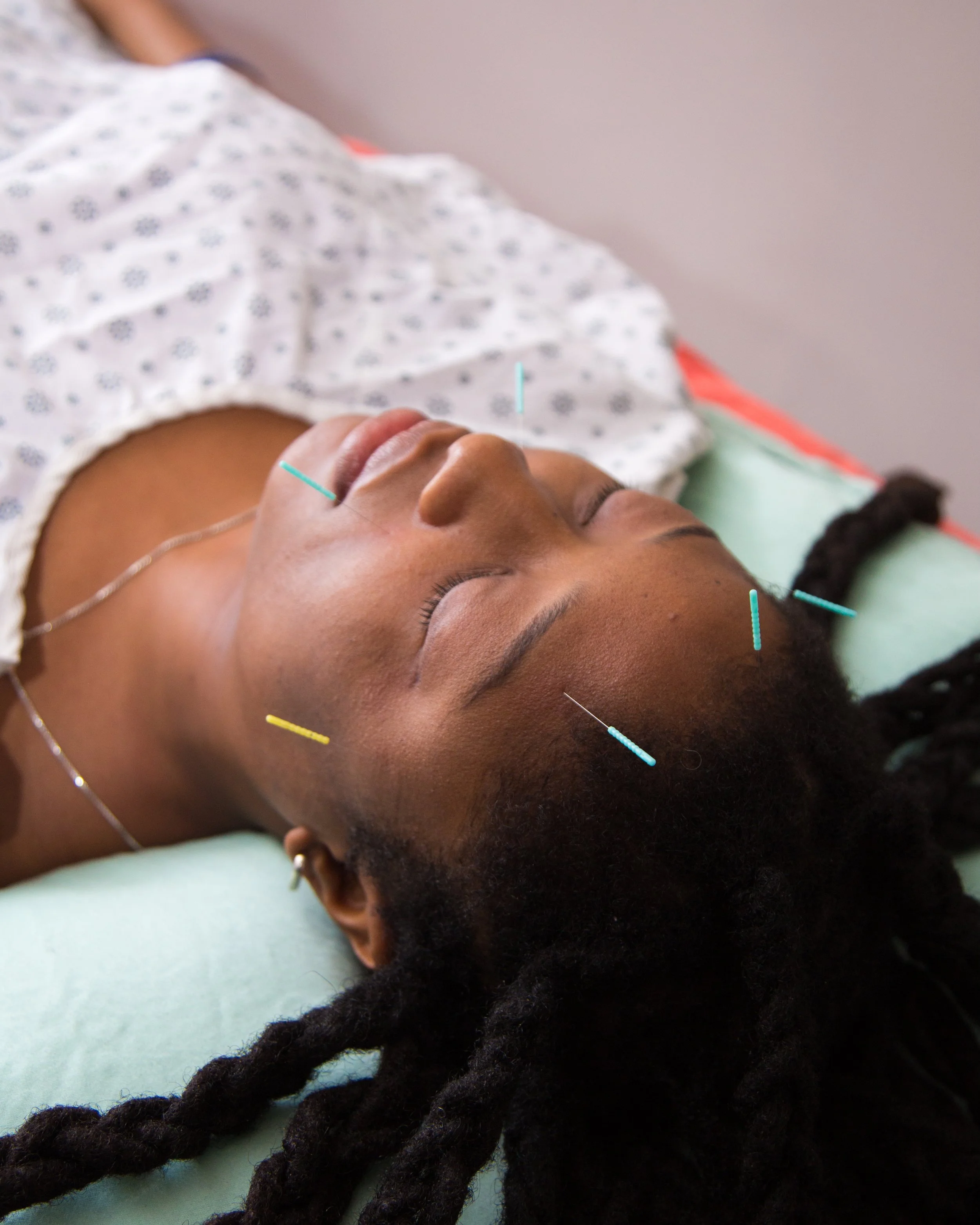 slideshow acupuncture.jpeg