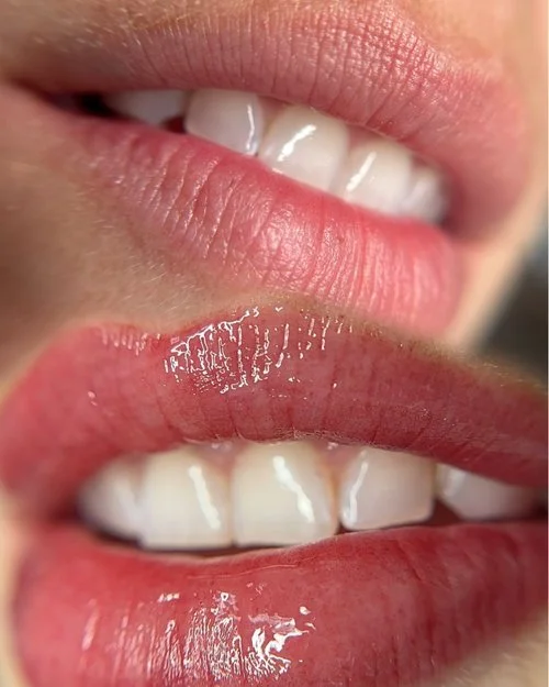Cosmetic Tattoo Lip Blush Before and After