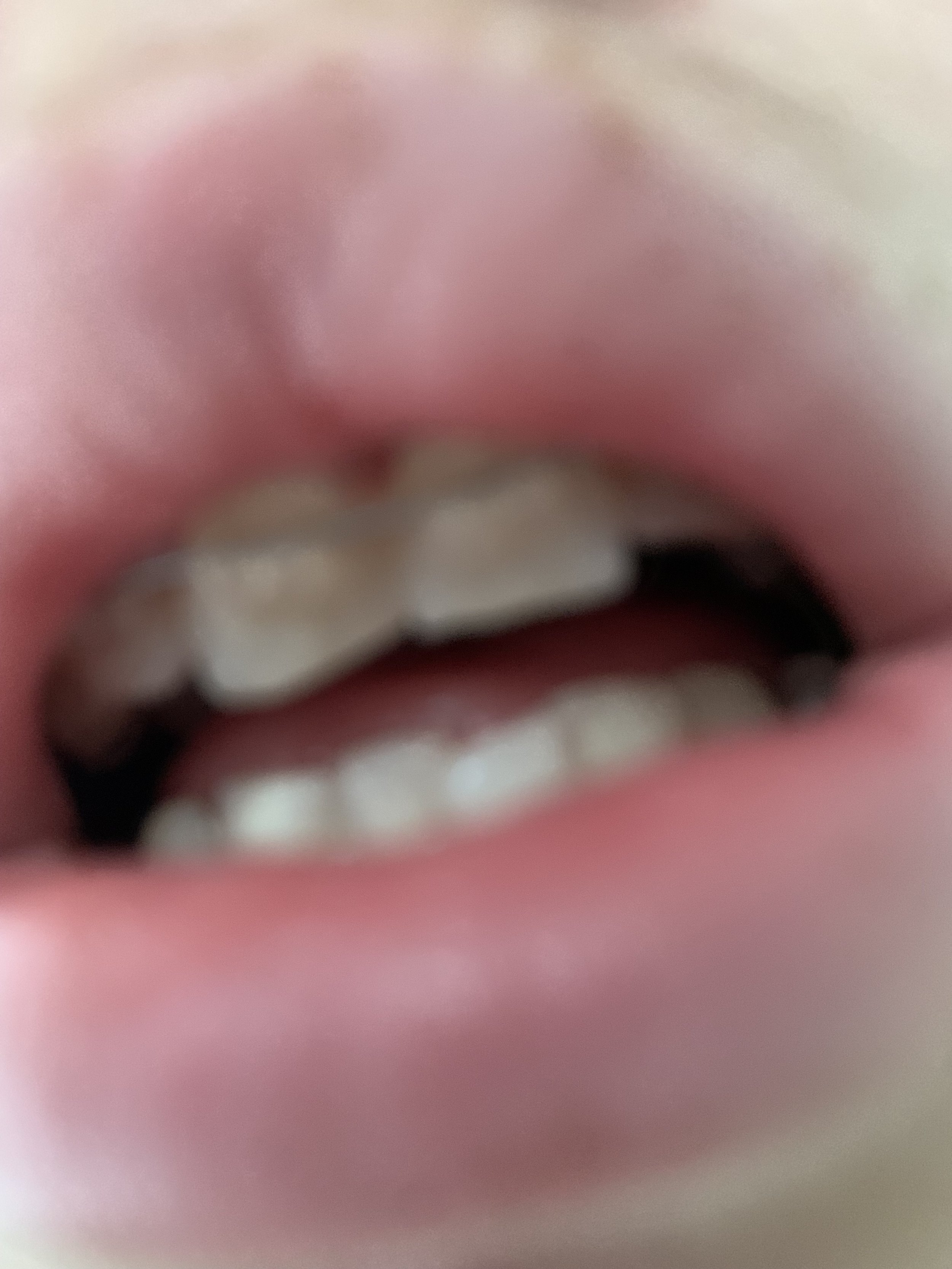 TEETH; SIN