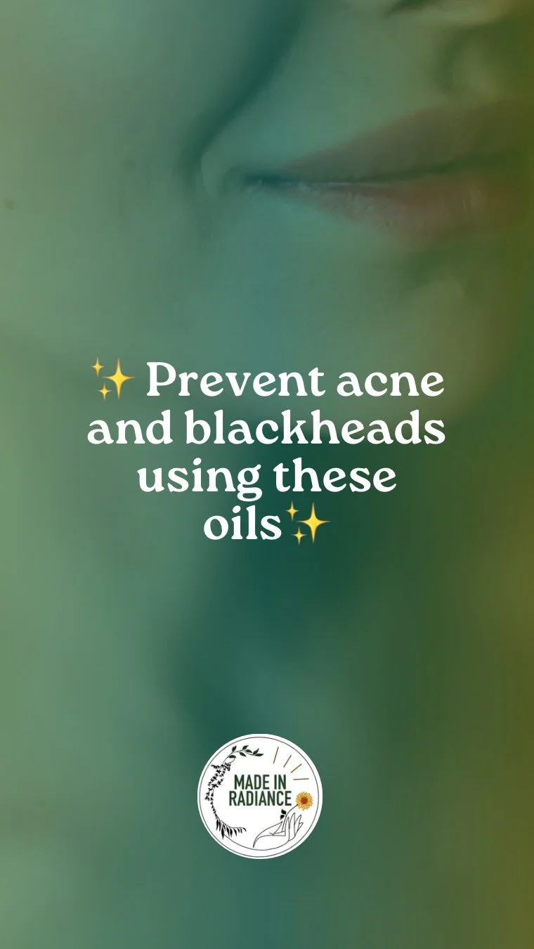 ✨Say goodbye to summer breakouts✨
If you’re struggling with acne or blackheads, these facial oils are your skin’s new best friend!
Buy any skin care with these oils in mind, you won’t regret it ✨let us know if these work for you!