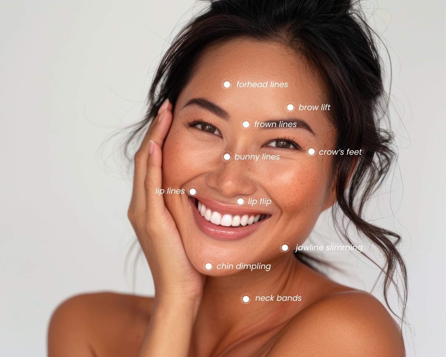 A smiling woman with various facial features labeled for aesthetic or cosmetic concern, including forehead lines, brow lift, frown lines, crow's feet, bunny lines, lip lines, lip flip, chin dimpling, jawline slimming, neck bands, and others.
