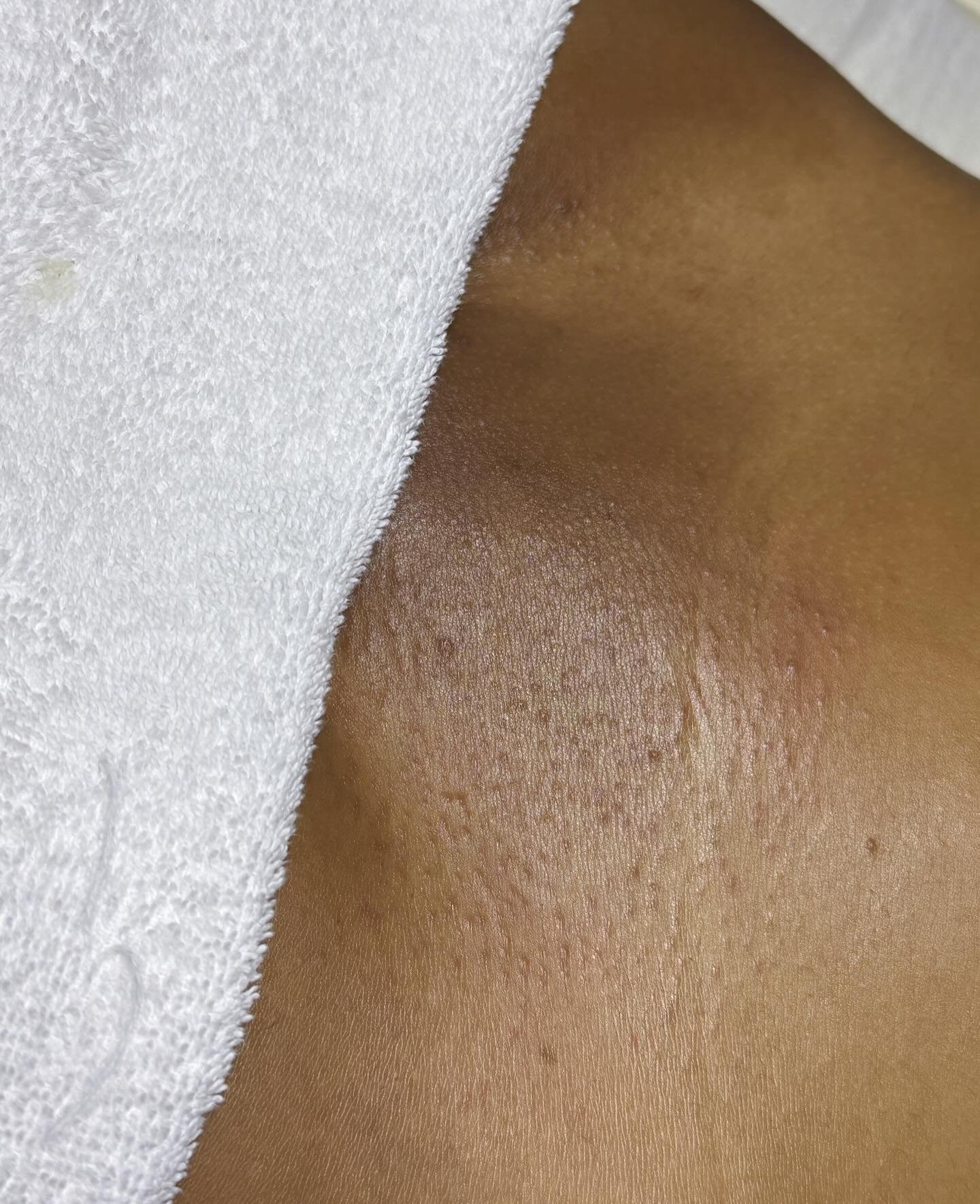 Smooth today, confident all month🥰
Let a body waxing specialist take care of that for you!

Always accepting new clients🌟
Message or hit the link in the bio 💌 

#bikiniwax #brazilian #wax #intimateskincare #spa