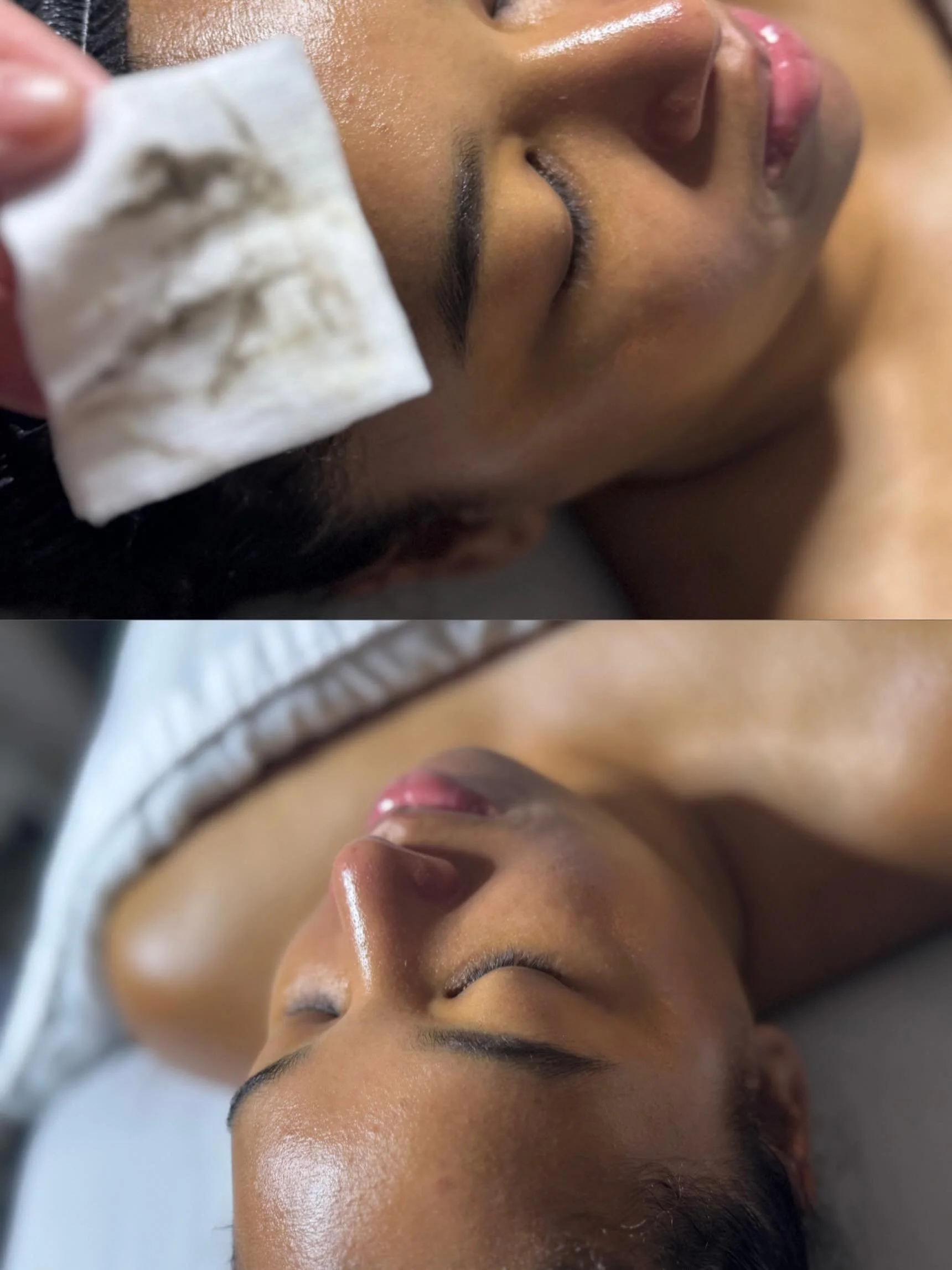 Beautiful skin revealed 🔪🥥💦

Dermaplaning is a great service to get if wanting a deeper exfoliation treatment so it will allow other products to penetrate deeper into the skin. 

#facial #dermaplaning #toledodermaplaning #toledoesthetician