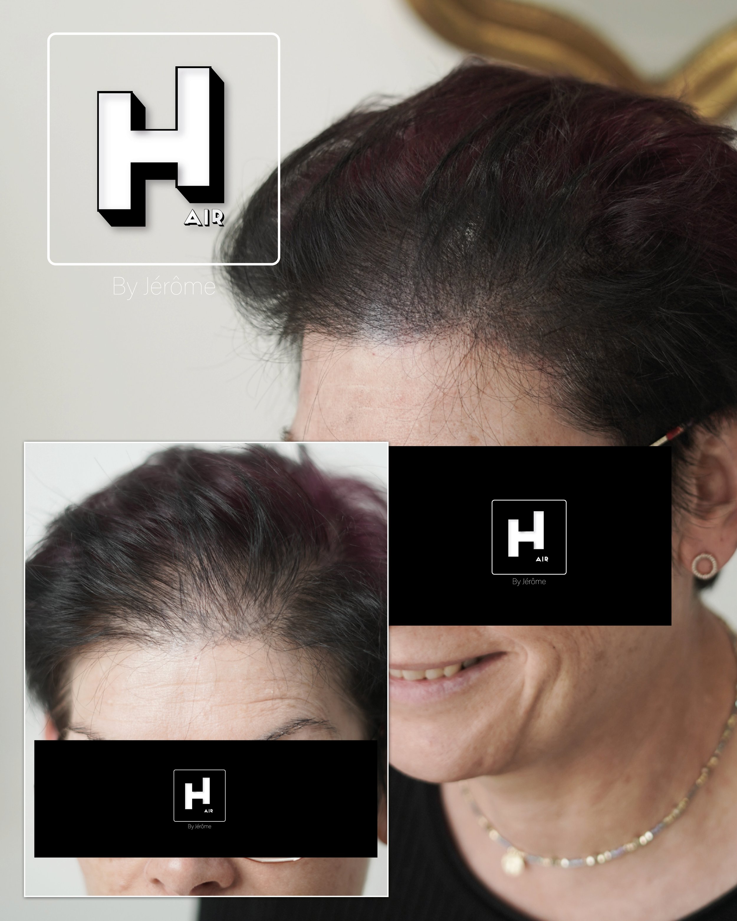 perte de cheveux femme france belgique.jpg