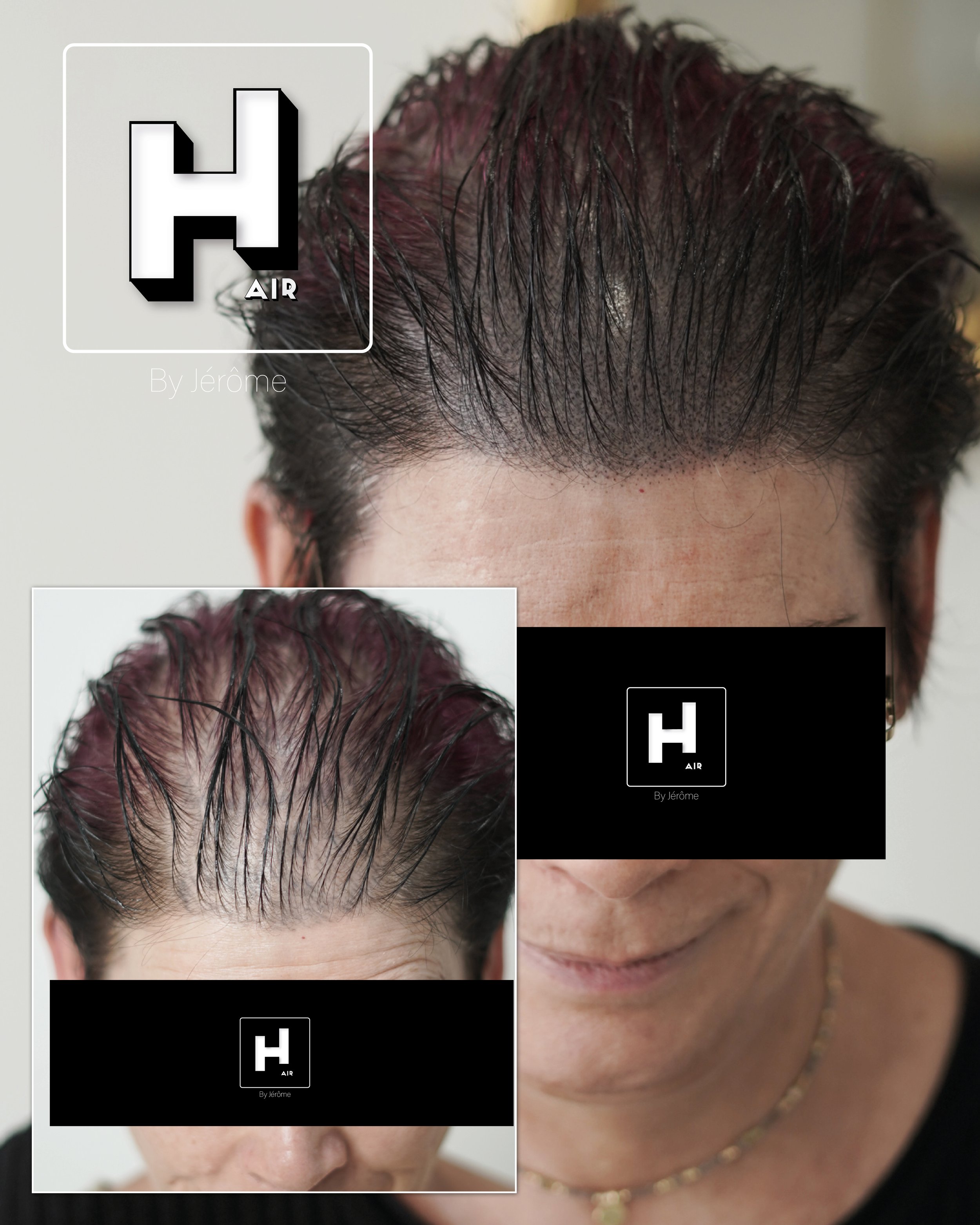 perte de cheveux femme france belgique5.jpg