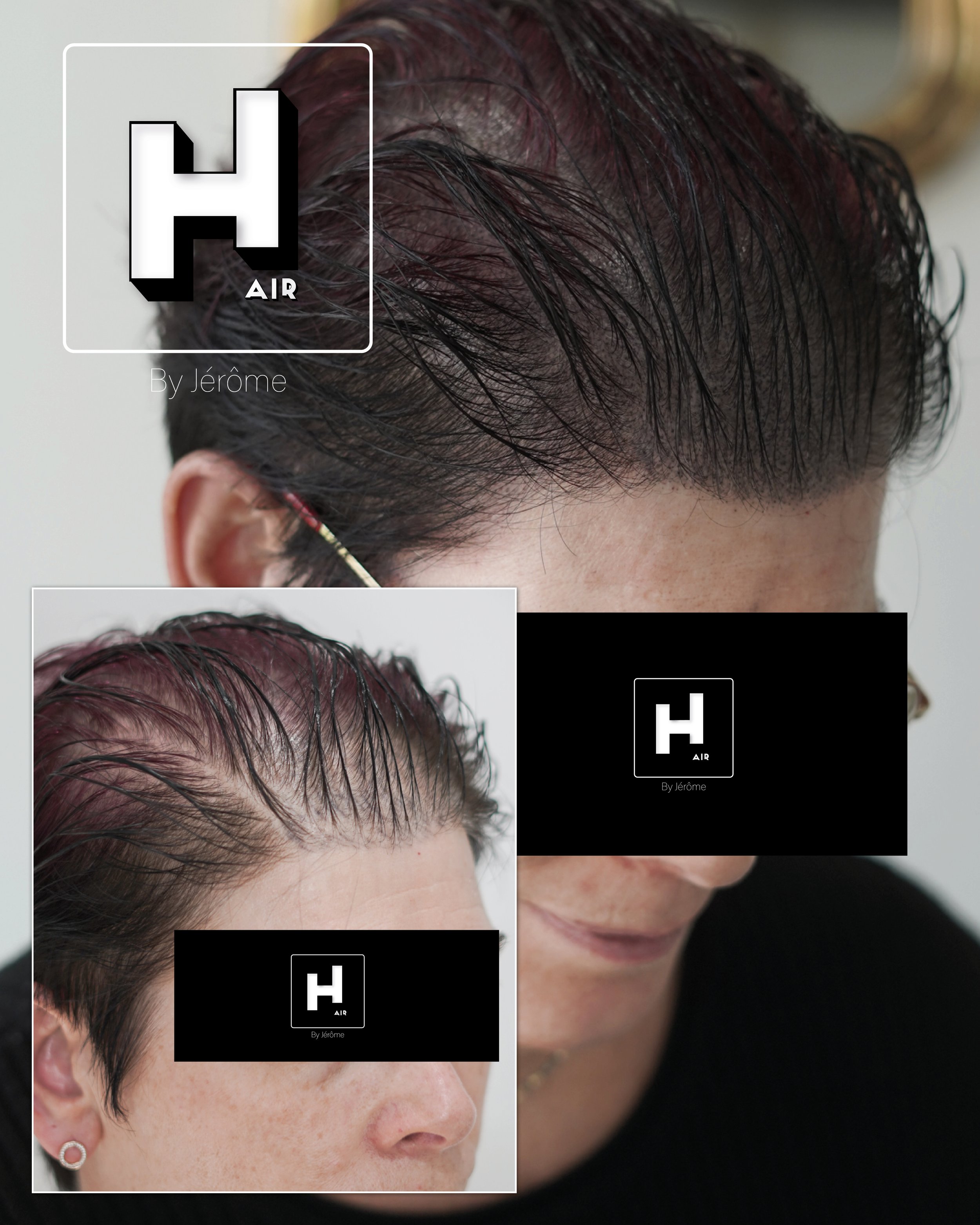 perte de cheveux femme france belgique8.jpg
