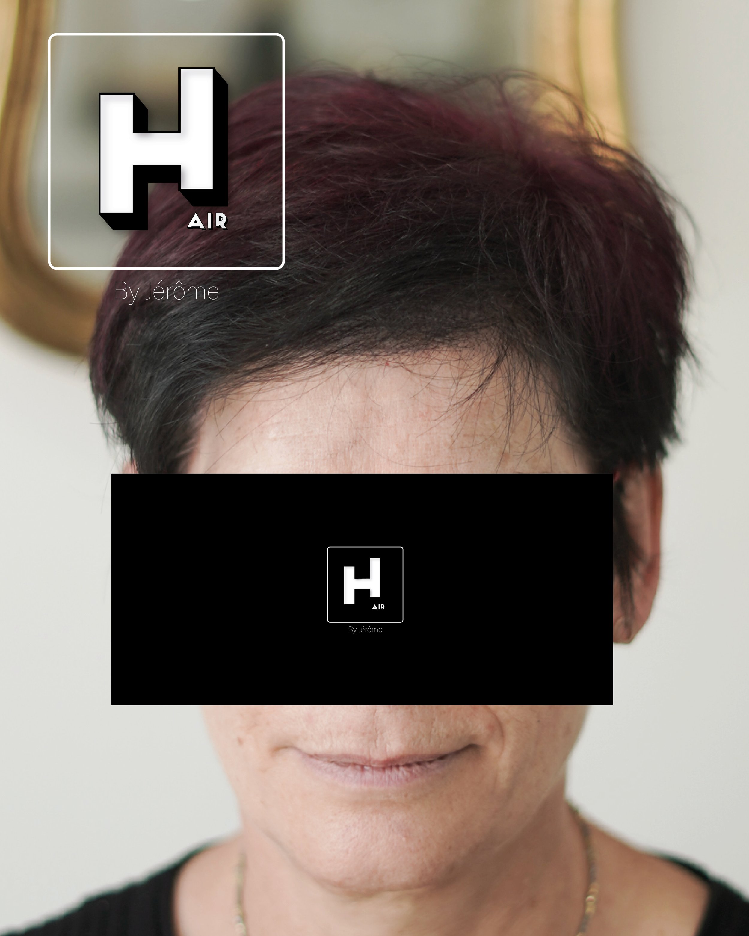 perte de cheveux femme france belgique9.jpg