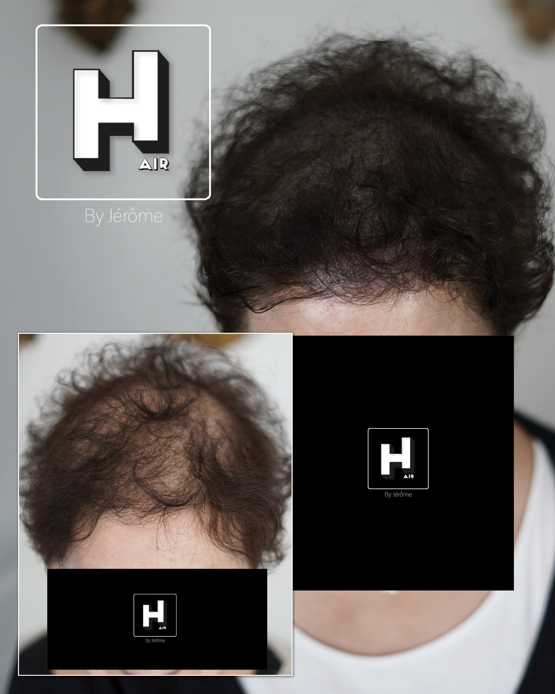 densité de cheveux femmes en france tricopigmentation.jpg