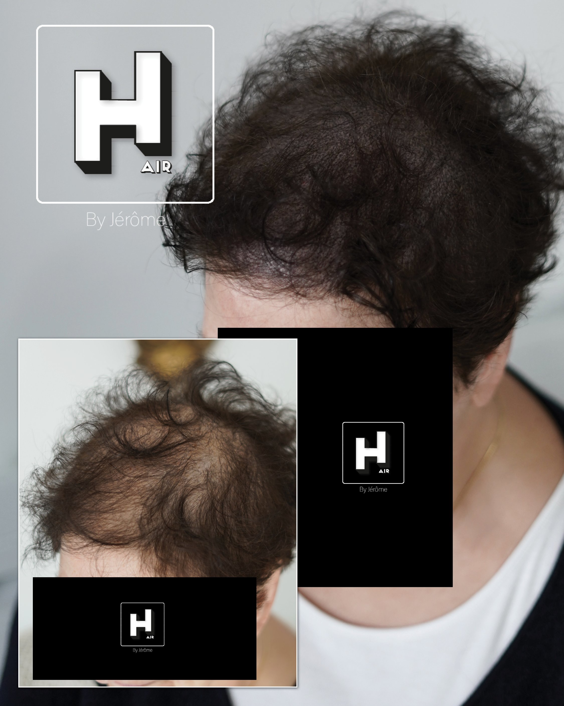 densité de cheveux femmes en france tricopigmentation5.jpg