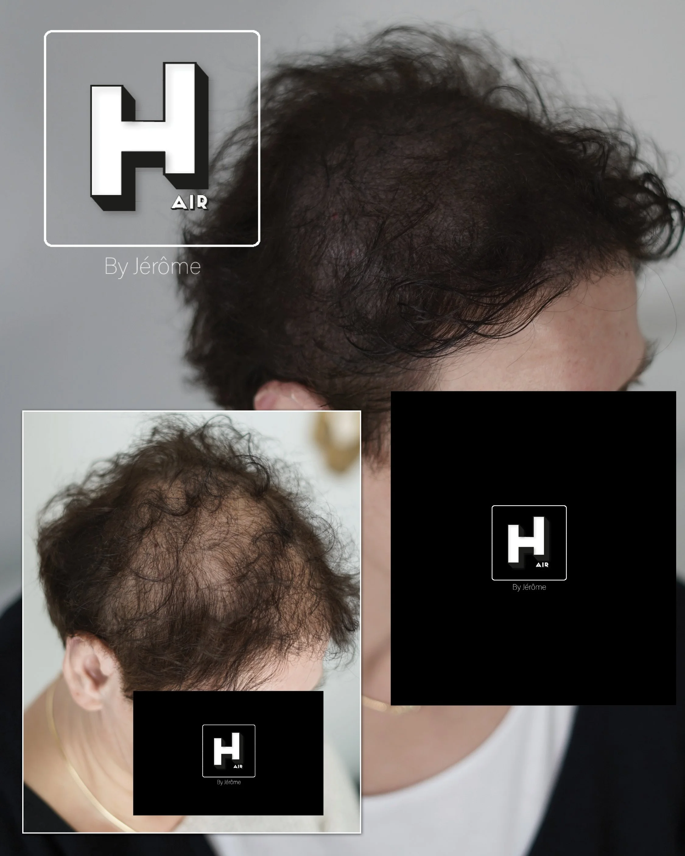 densité de cheveux femmes en france tricopigmentation6.jpg