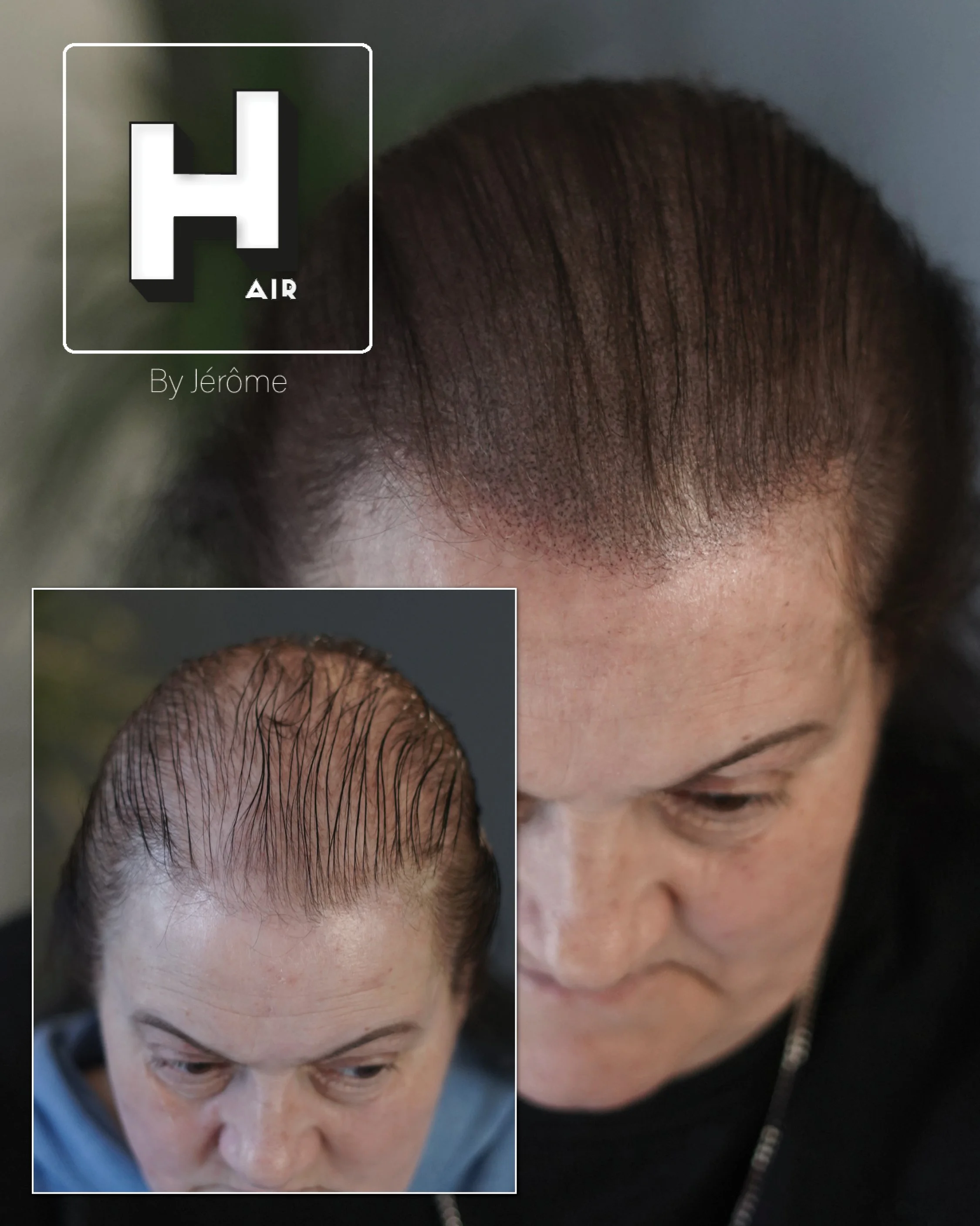 perte densité cheveux femme 2.jpg