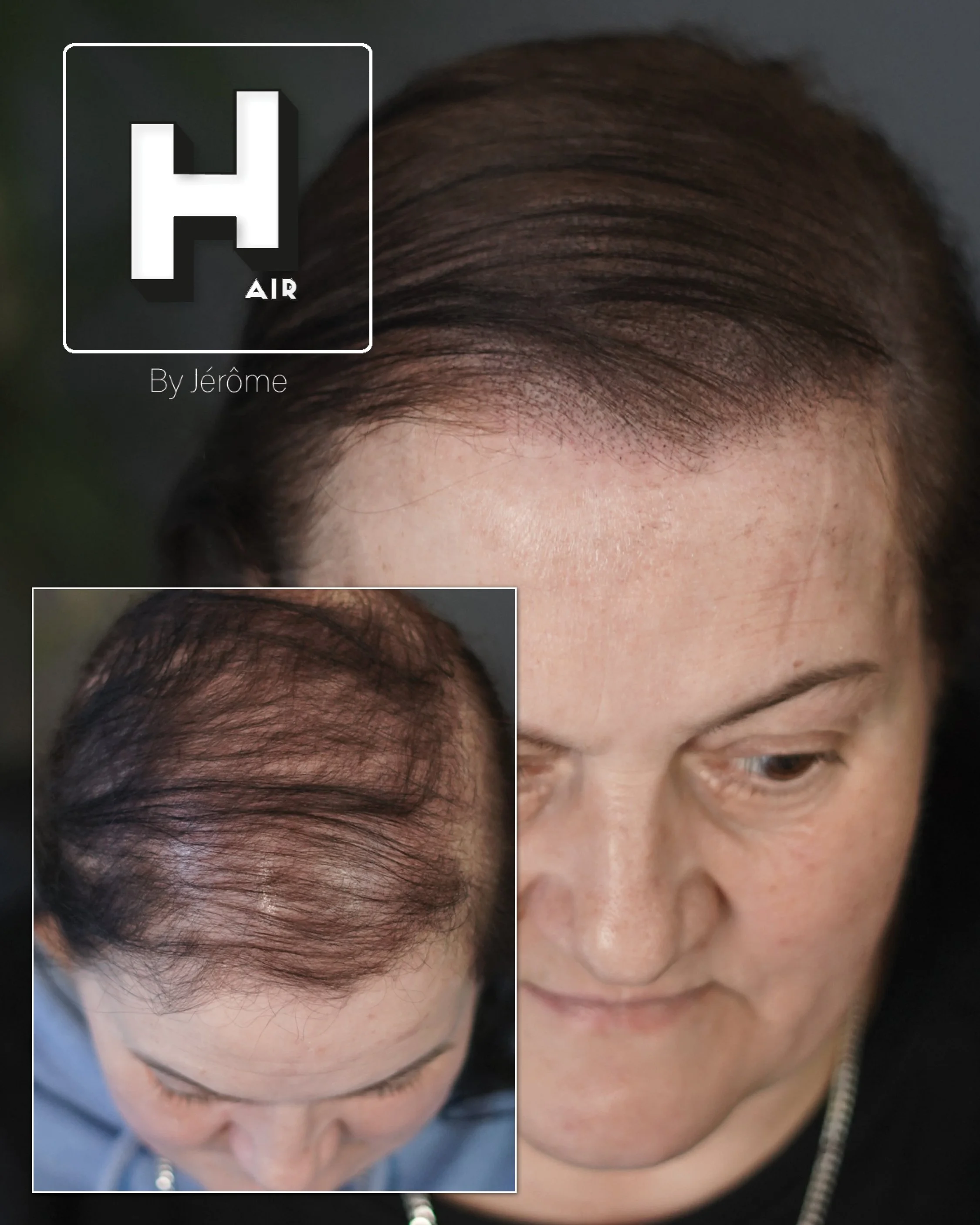 perte densité cheveux femme 3.jpg