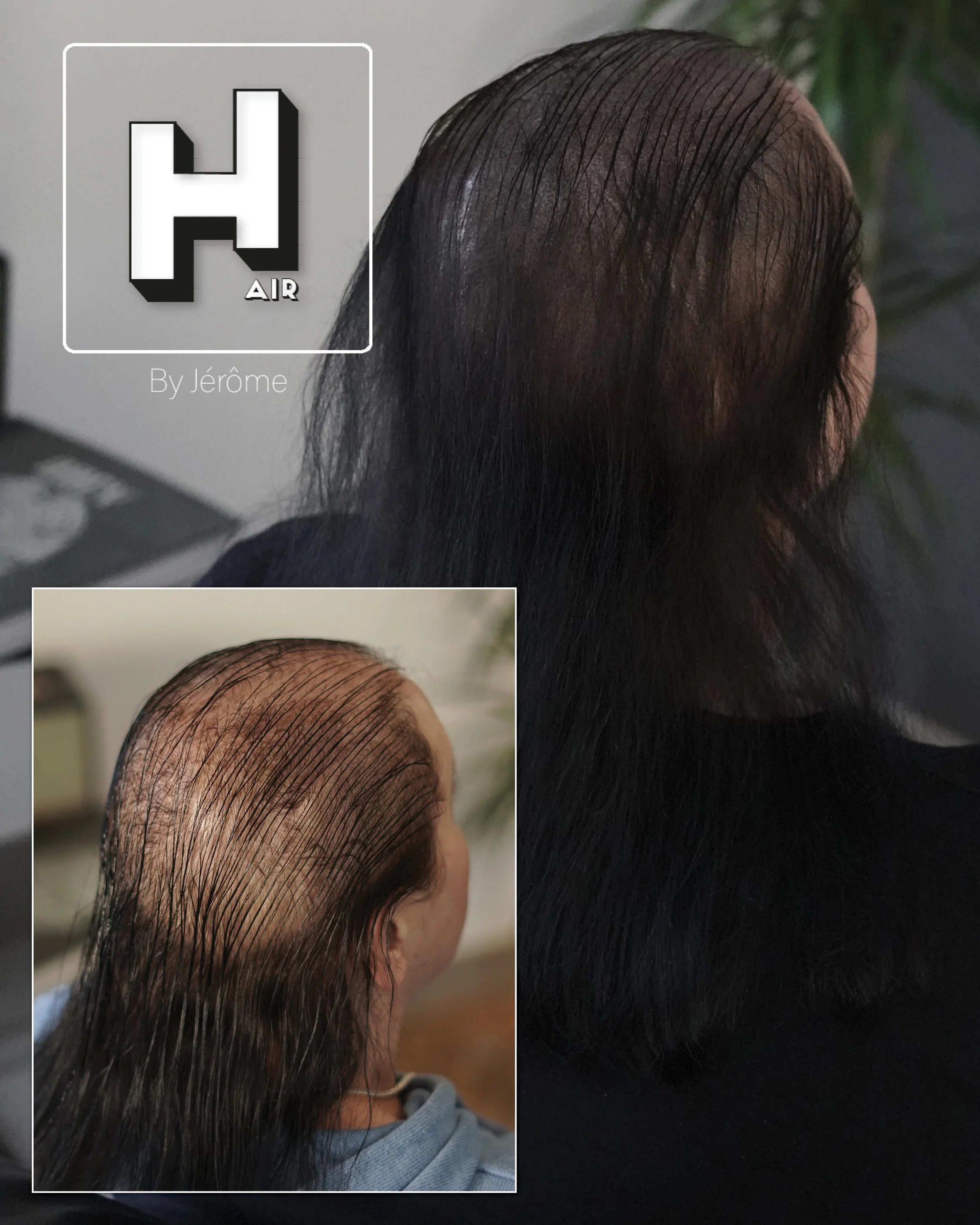 perte densité cheveux femme 5.jpg