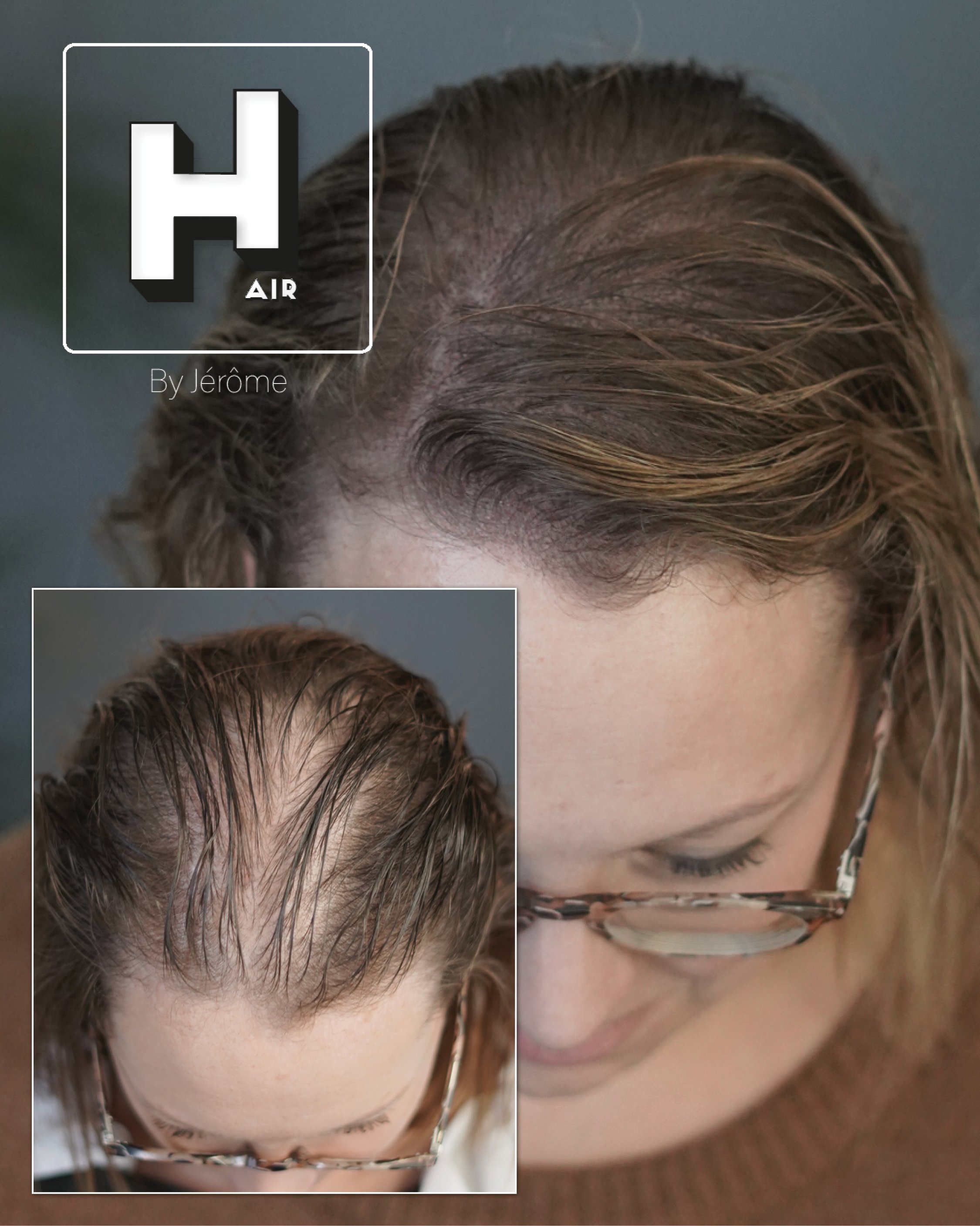 probleme de cheveux chez la femme.jpg