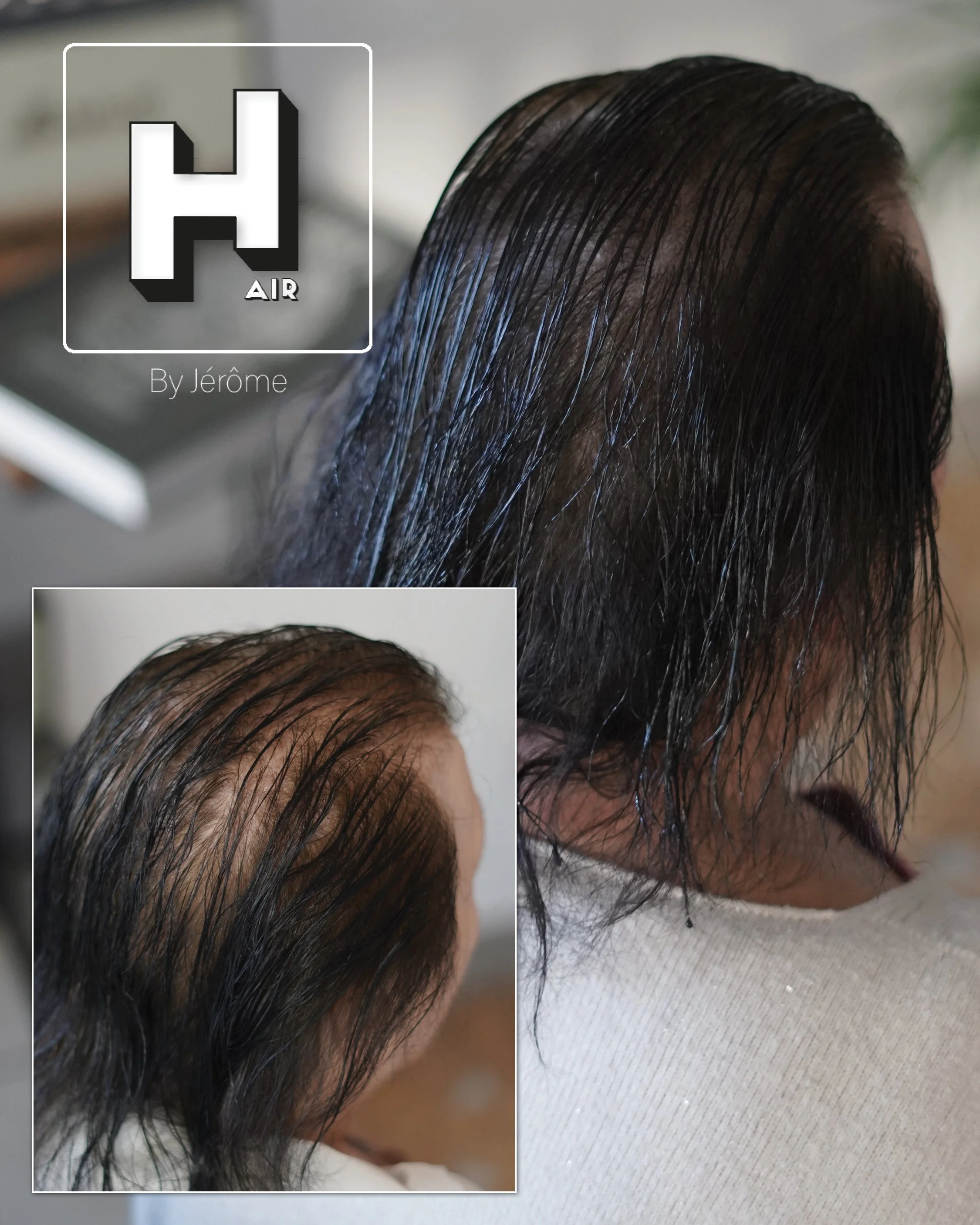 tricopigmentation homme femme belgique france6.jpg