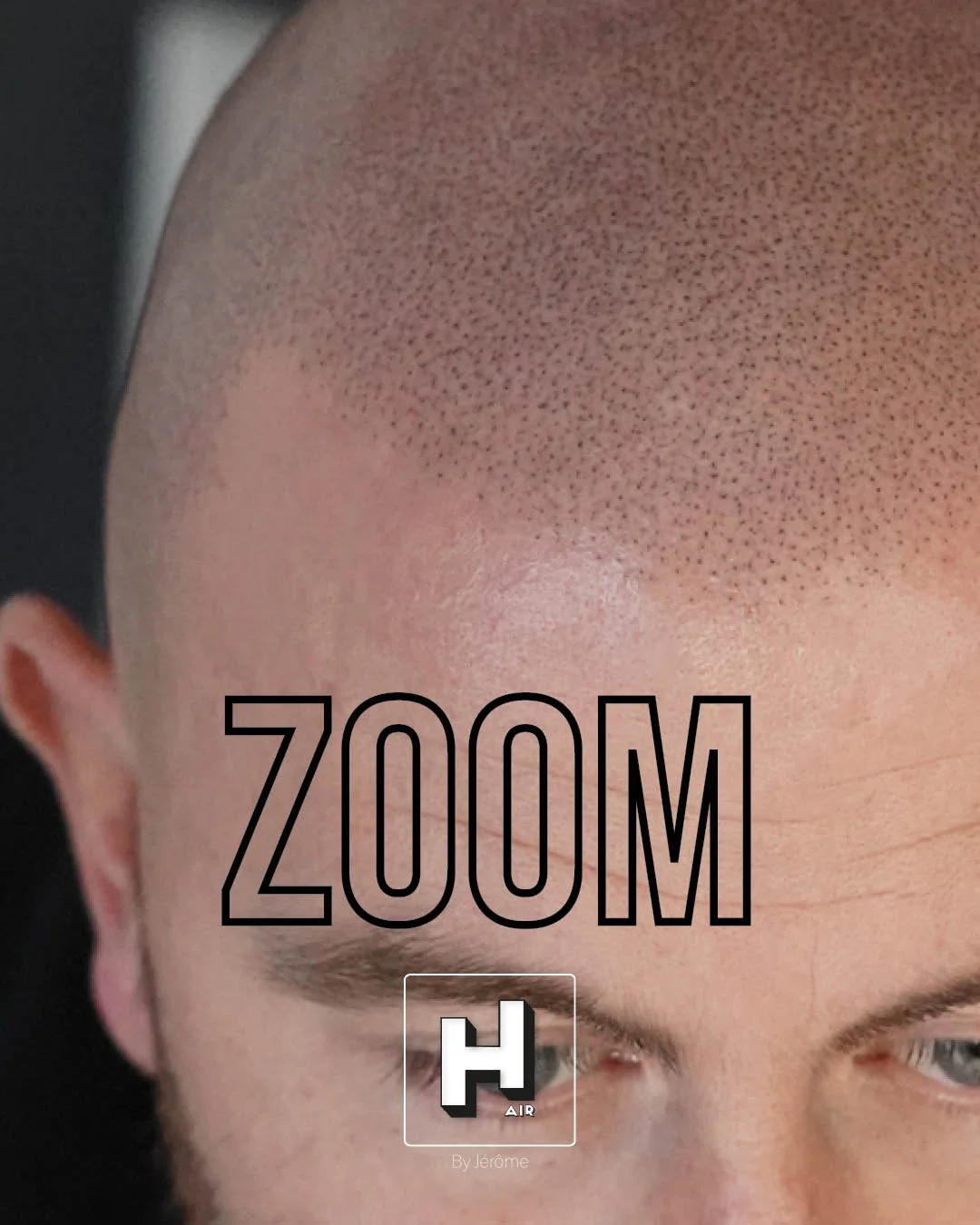 Hair by jerome effet rasé micropigmentation capillaire2.jpg
