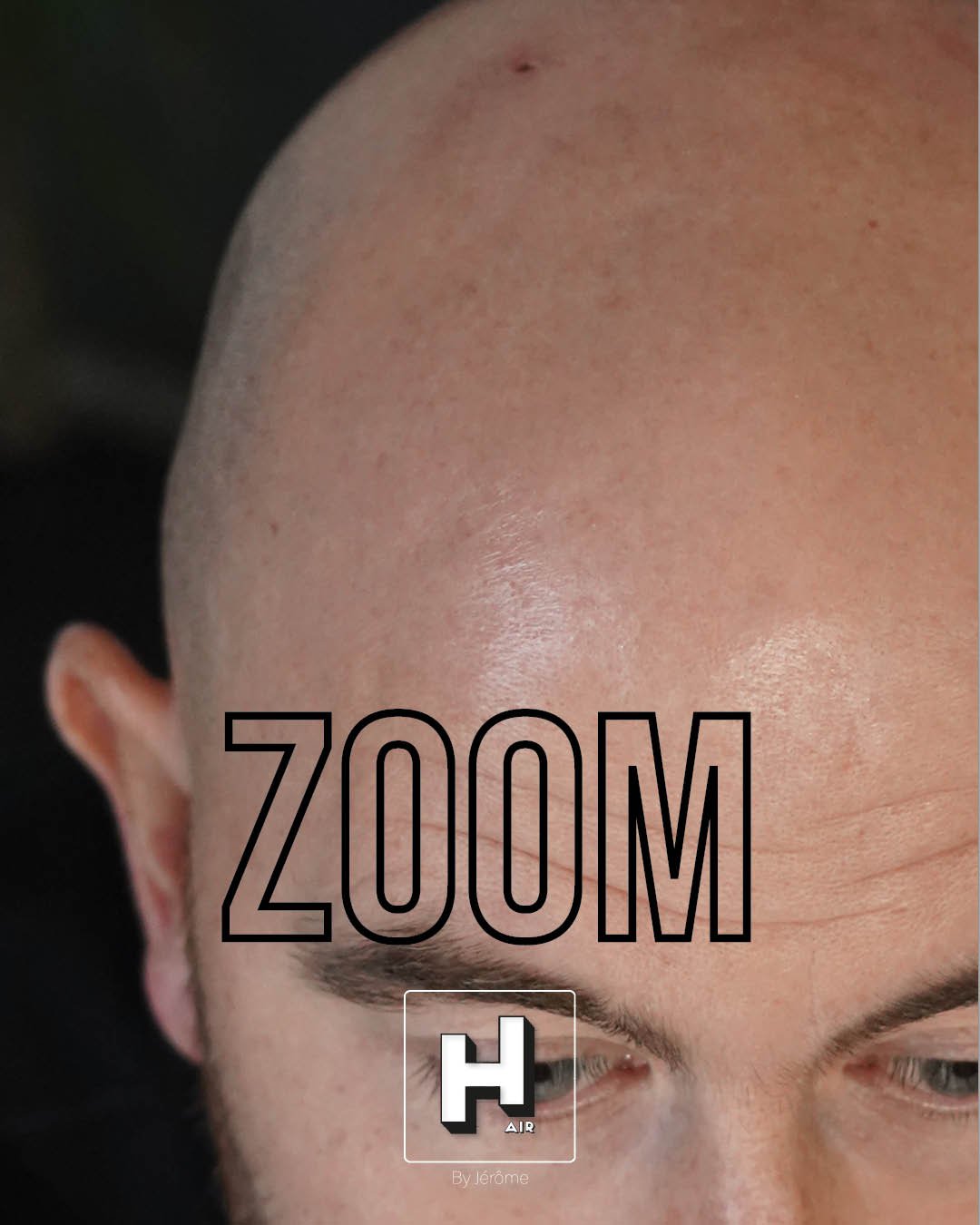 Hair by jerome effet rasé micropigmentation capillaire3.jpg