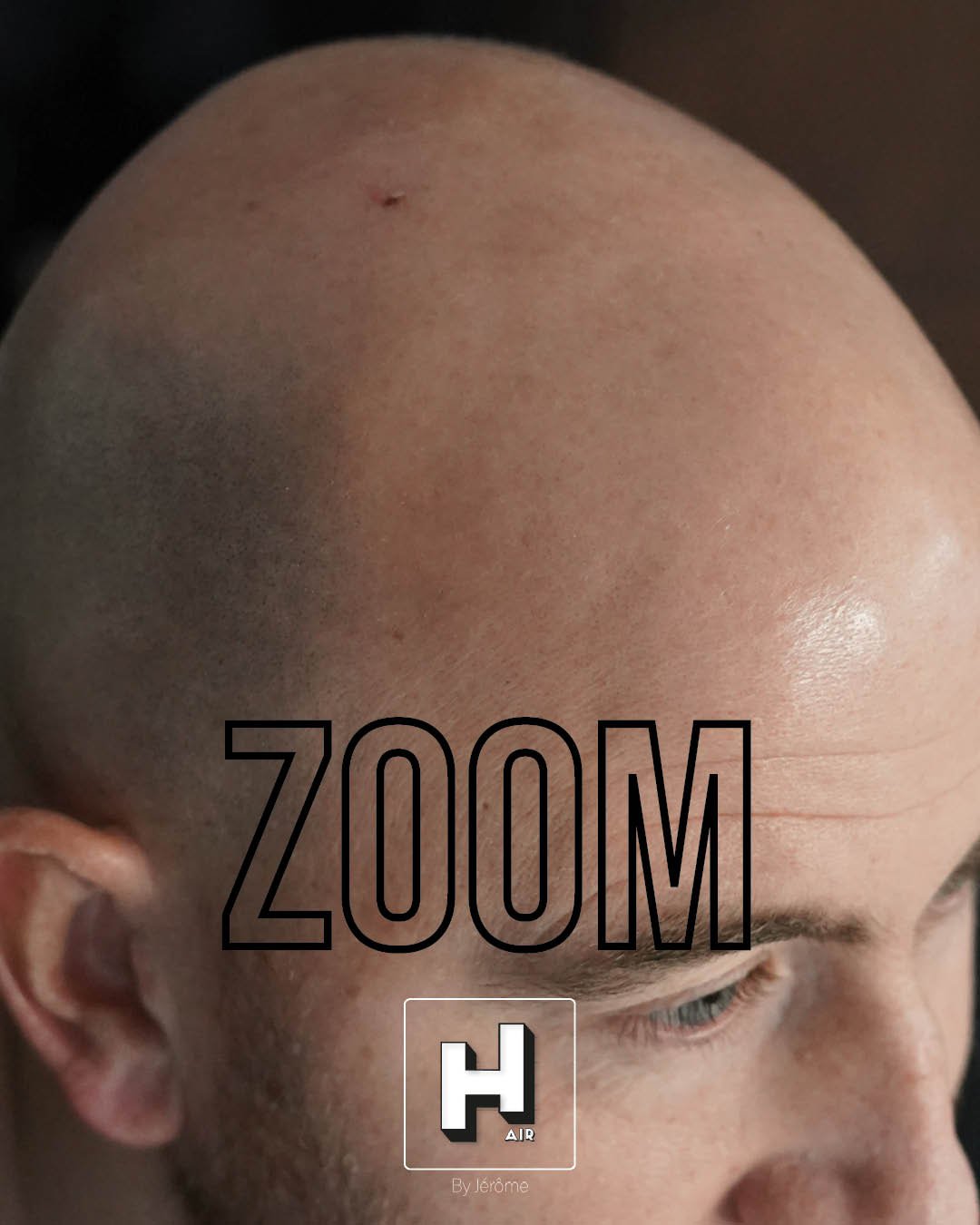 Hair by jerome effet rasé micropigmentation capillaire4.jpg