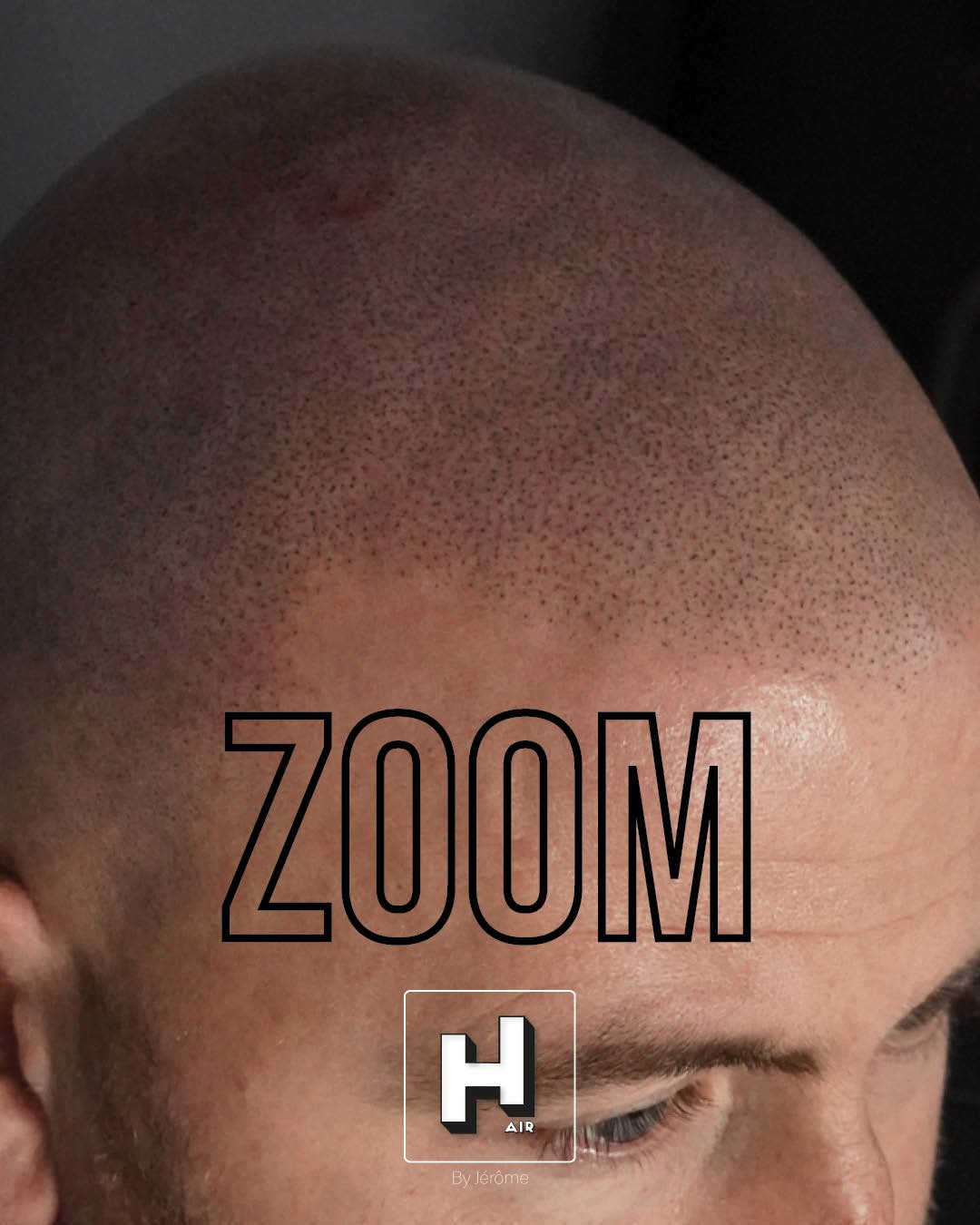 Hair by jerome effet rasé micropigmentation capillaire5.jpg
