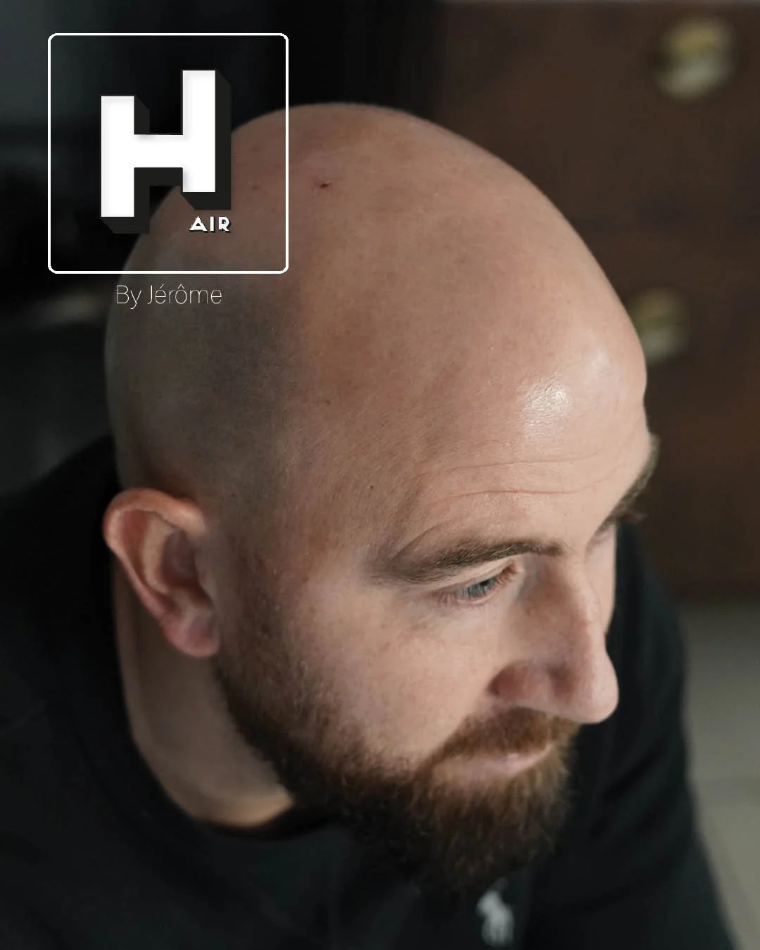 Hair by jerome effet rasé micropigmentation capillaire8.jpg