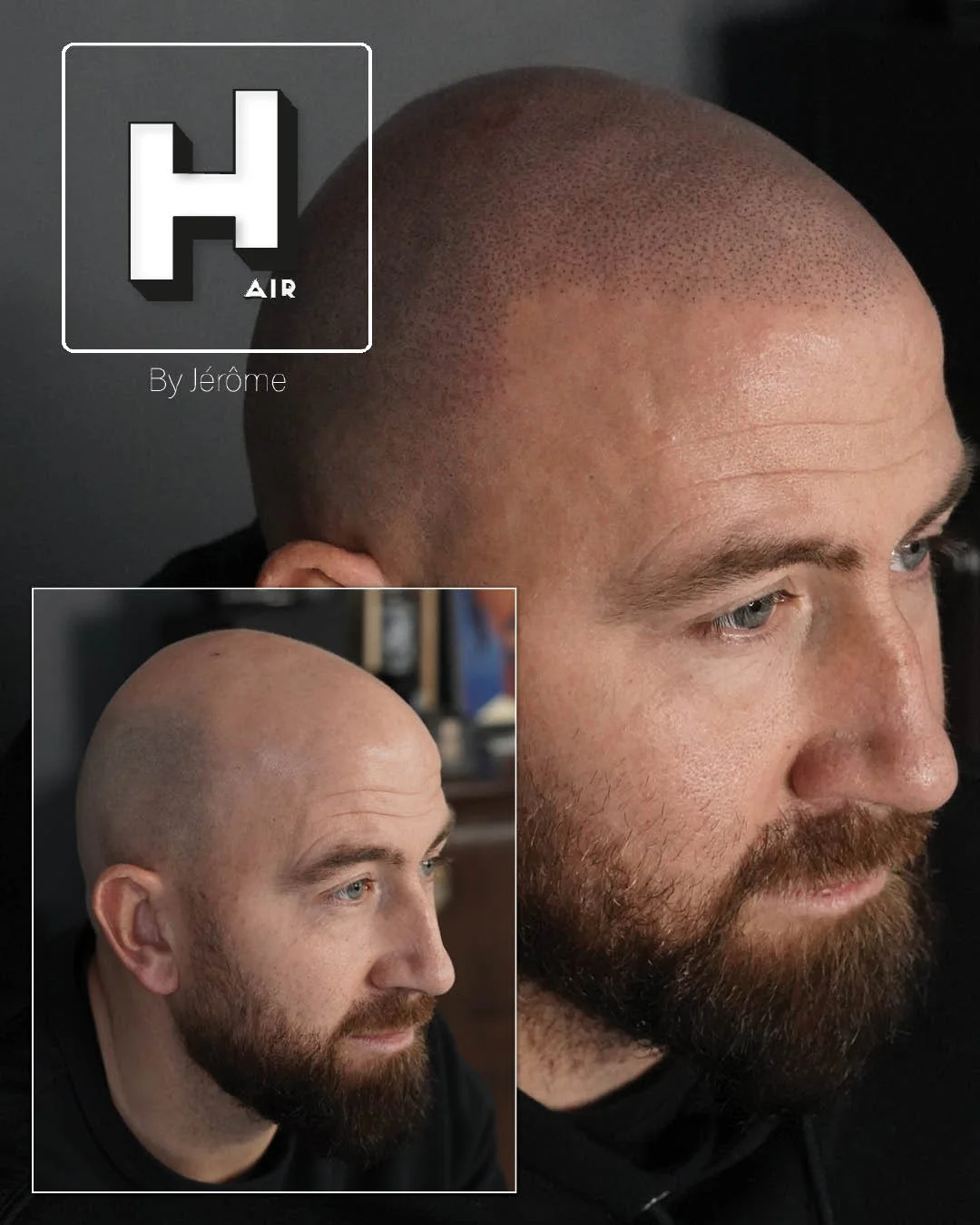 Hair by jerome effet rasé micropigmentation capillaire7.jpg