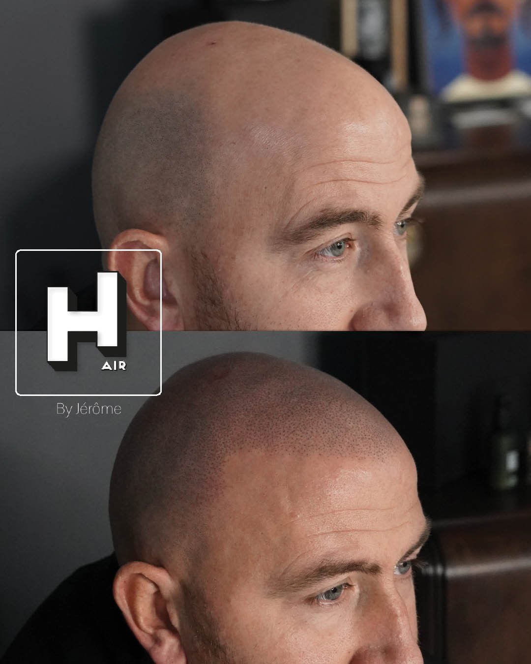 Hair by jerome effet rasé micropigmentation capillaire10.jpg