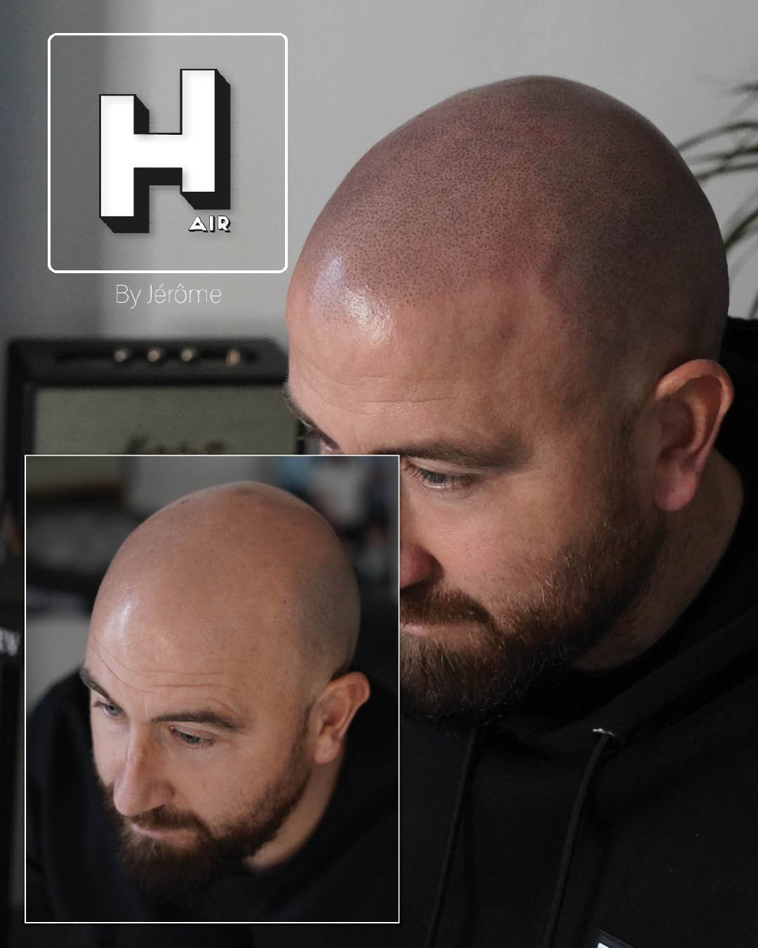 Hair by jerome effet rasé micropigmentation capillaire11.jpg