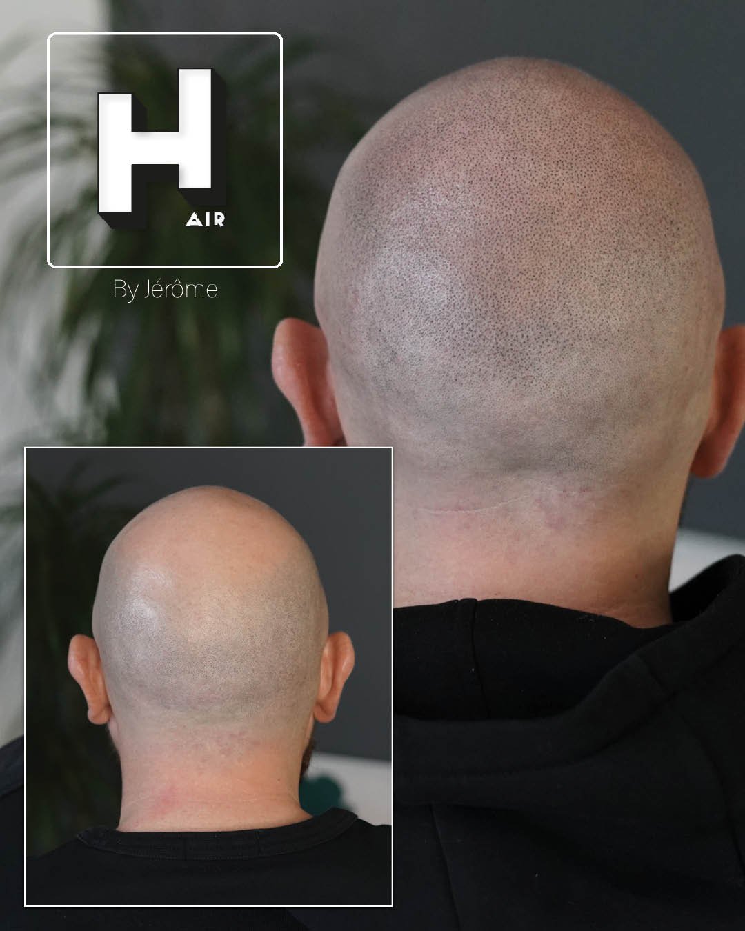 Hair by jerome effet rasé micropigmentation capillaire12.jpg