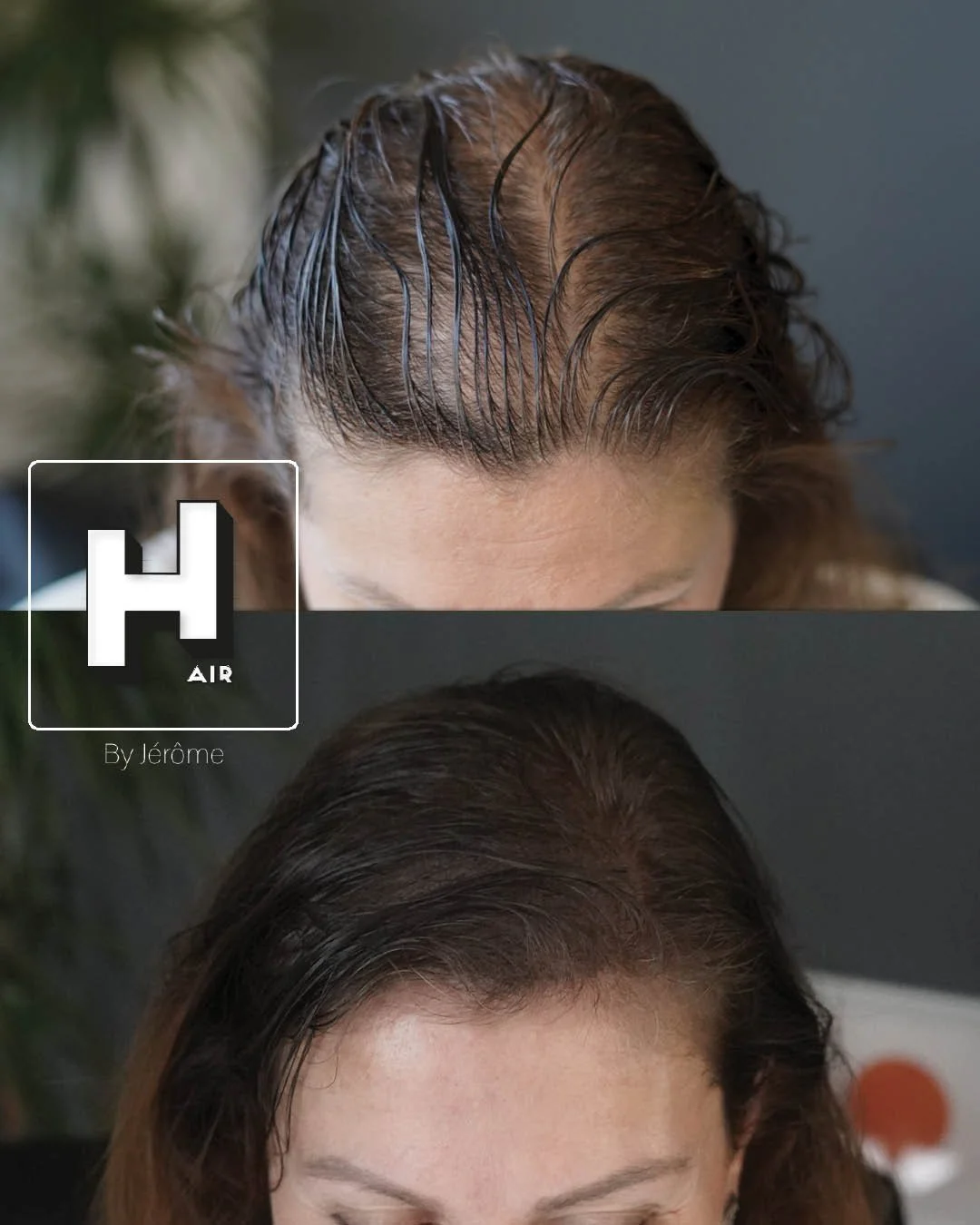 Densité cheveux femmes solution perte de cheveux.jpg