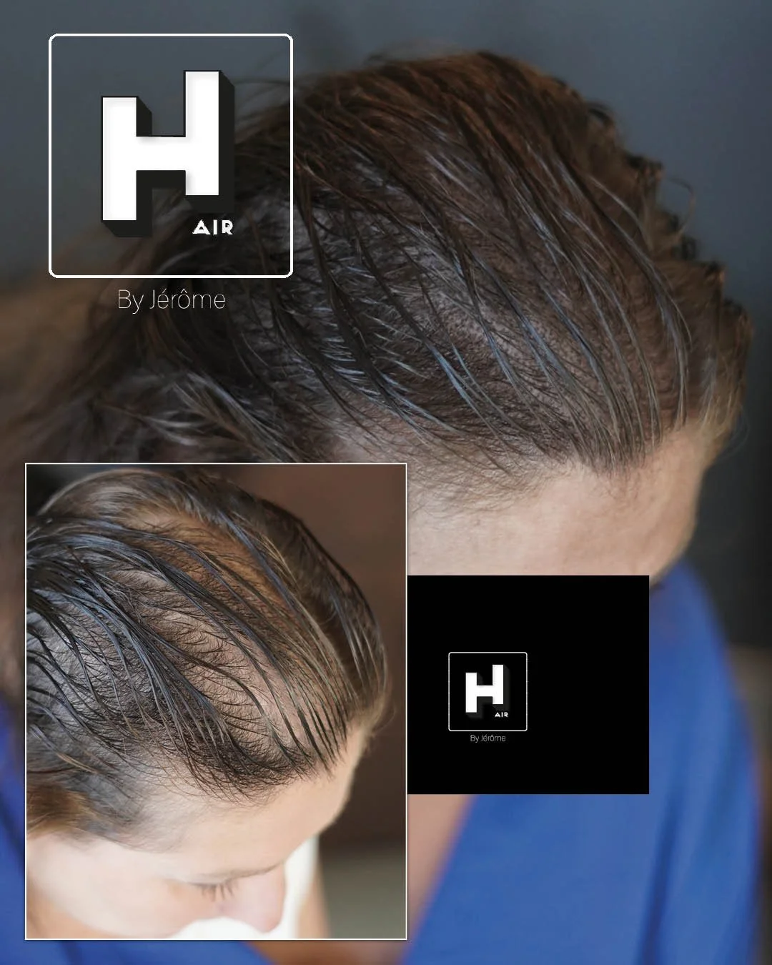 Micropigmentation Luxembourg maison derma......jpg
