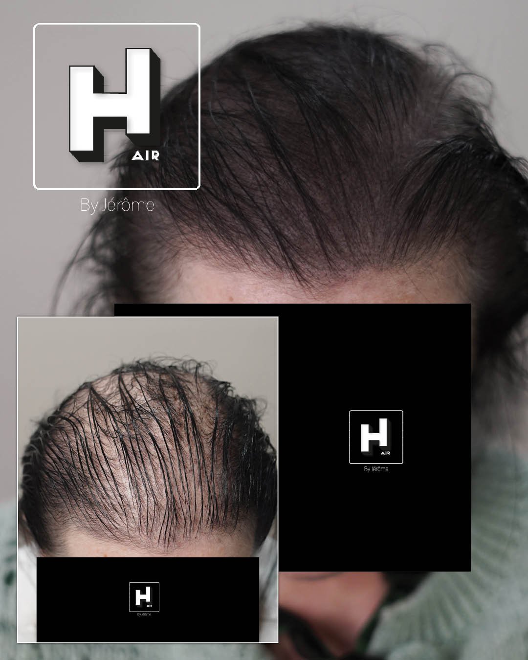 perte cheveux femme.jpg