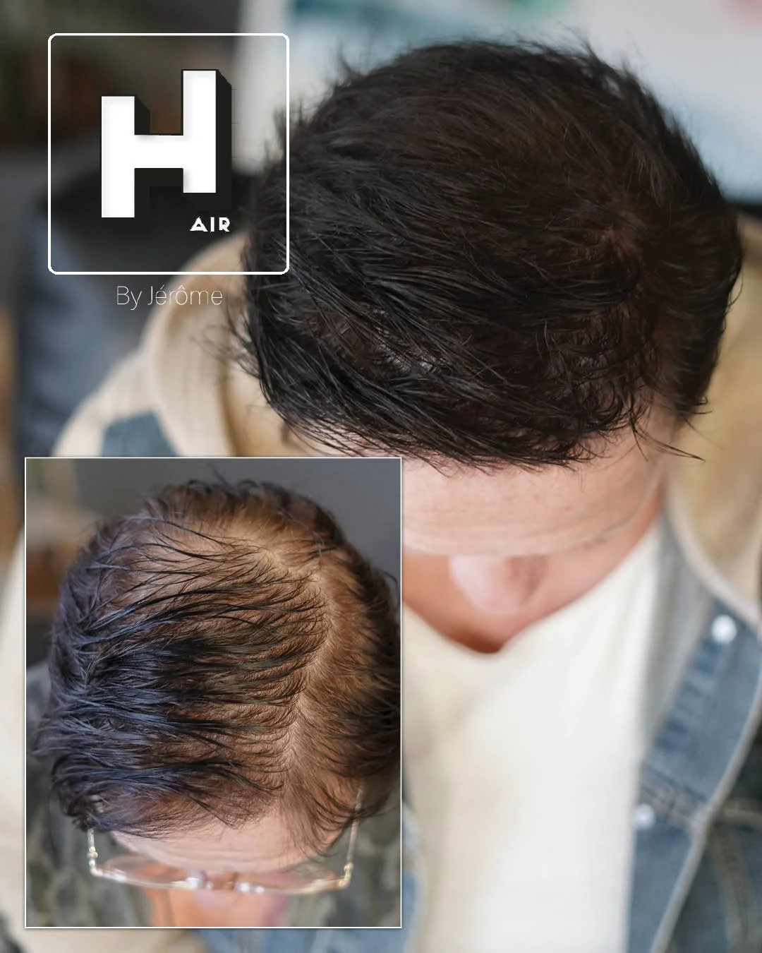 perte de cheveux femme namur.jpg