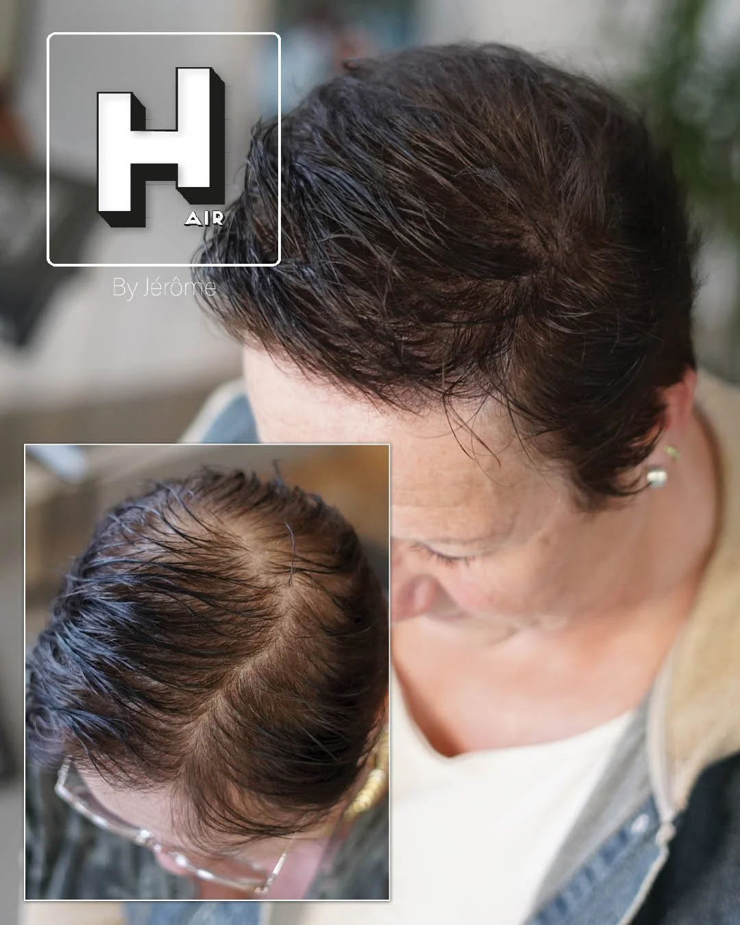 perte de cheveux femme namur2.jpg