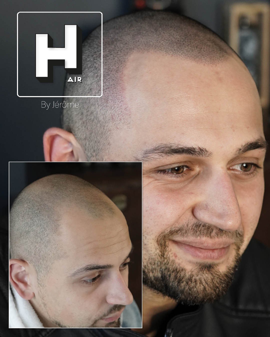 effet rasé calvitie hair by jerome.jpg