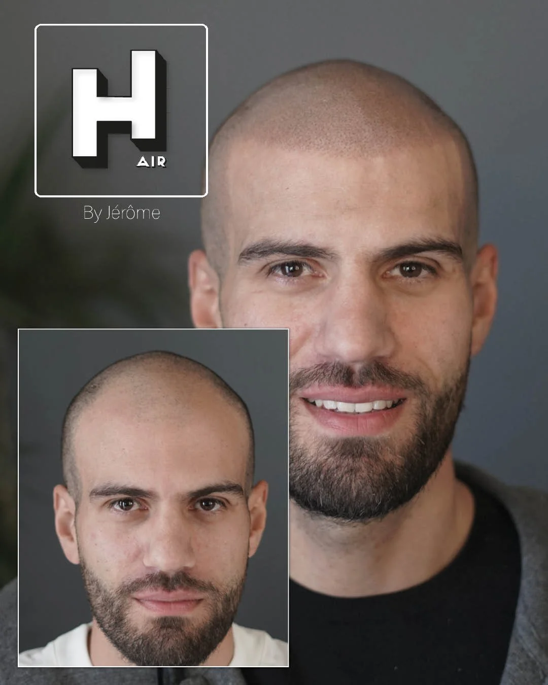 Micropigmentation Luxembourg maison derma.....jpg