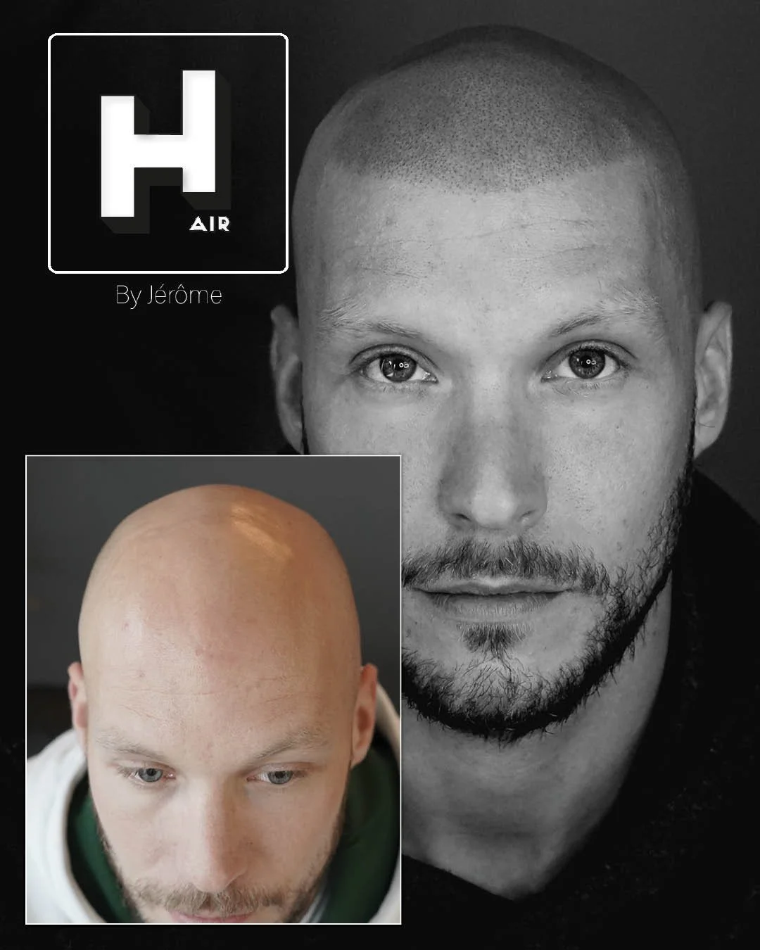 Micropigmentation Luxembourg maison derma.......jpg