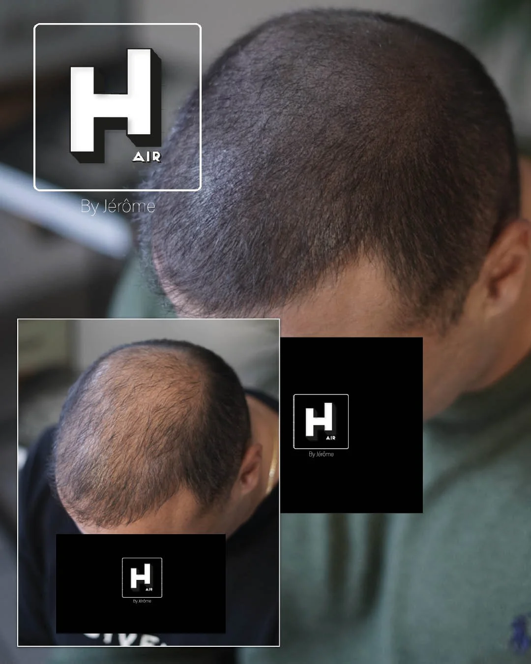 complement greffe hair by jerome2.jpg