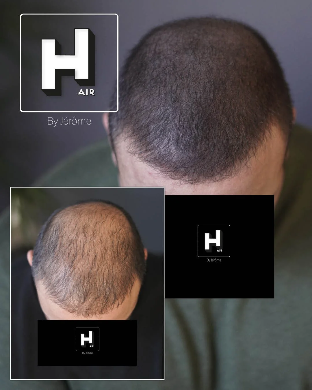 complement greffe hair by jerome3.jpg